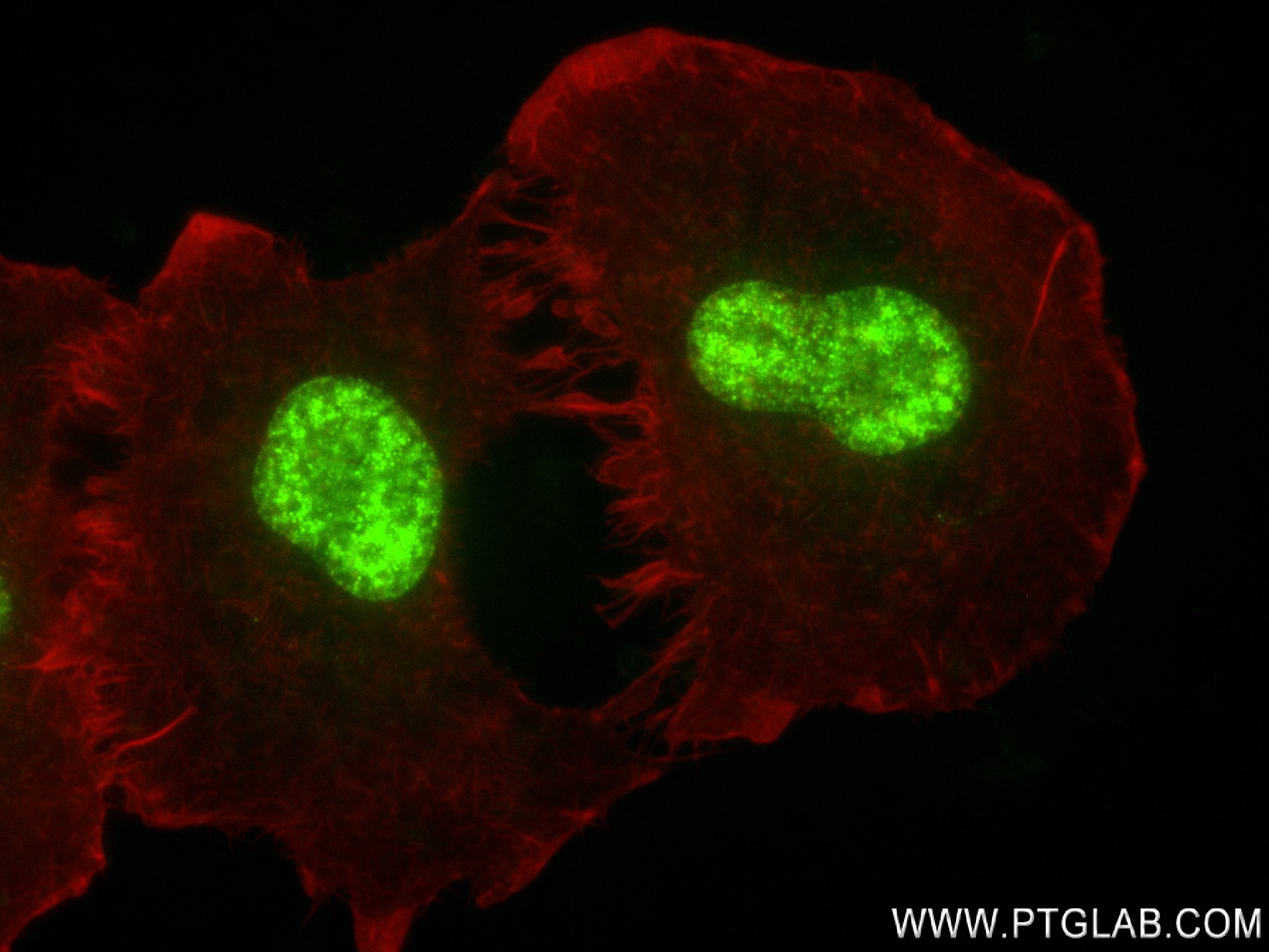 IF Staining of A549 using 83580-1-RR (same clone as 83580-1-PBS)