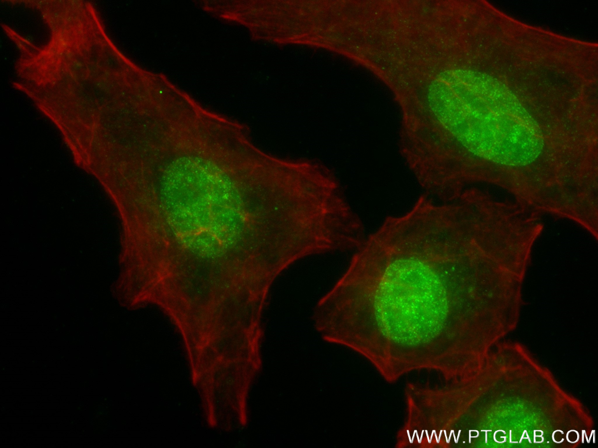 IF Staining of A549 using 83580-5-RR