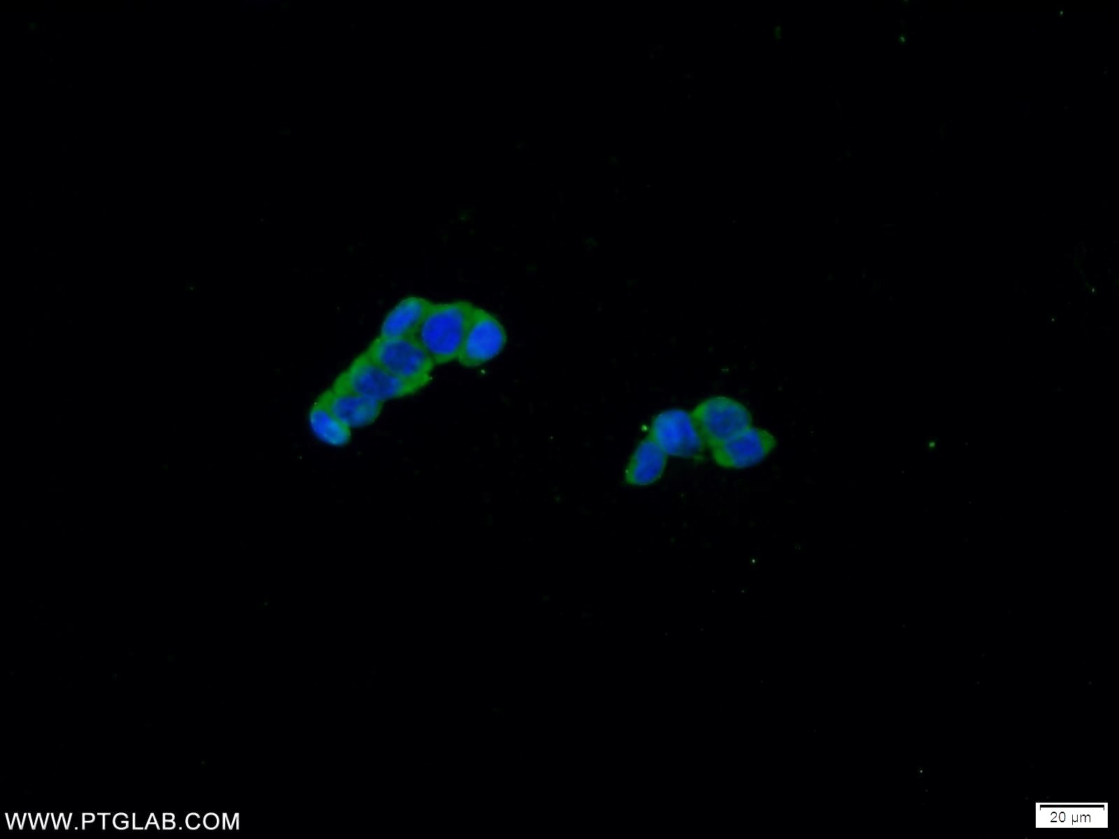 IF Staining of HEK-293 using 21869-1-AP