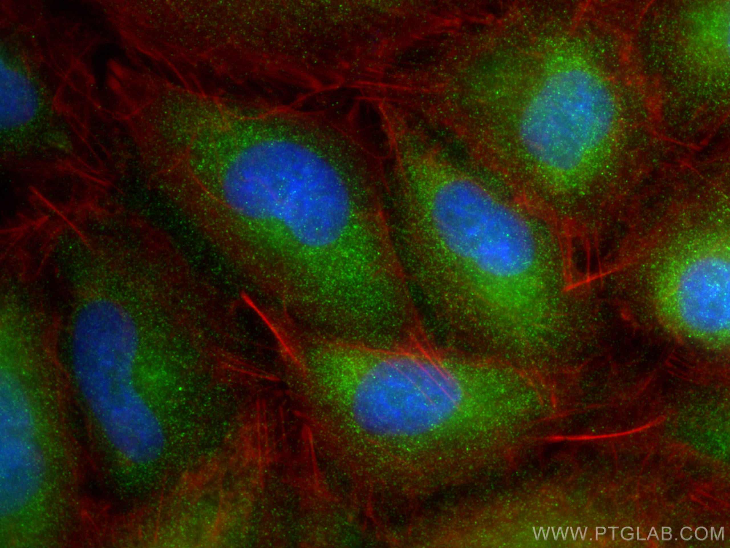 IF Staining of A549 using 13397-1-AP