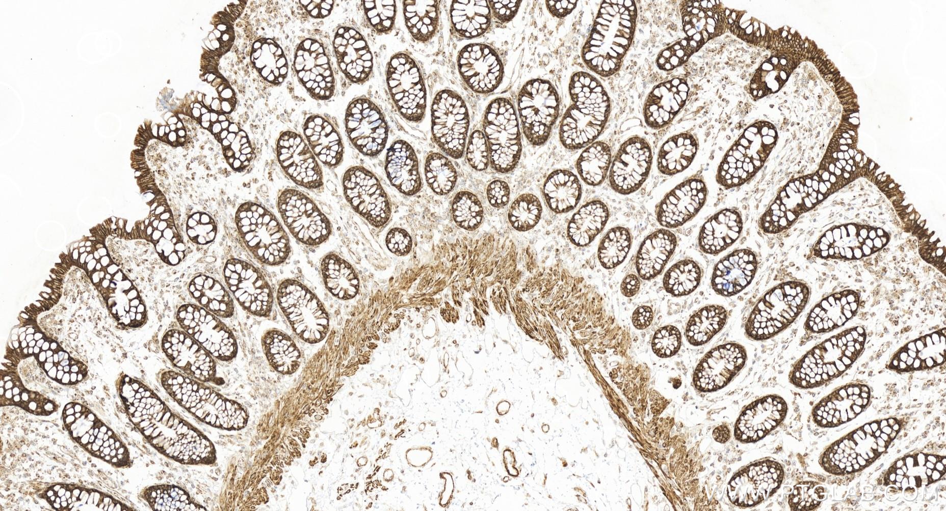 IHC staining of human colon using 84413-3-RR (same clone as 84413-3-PBS)