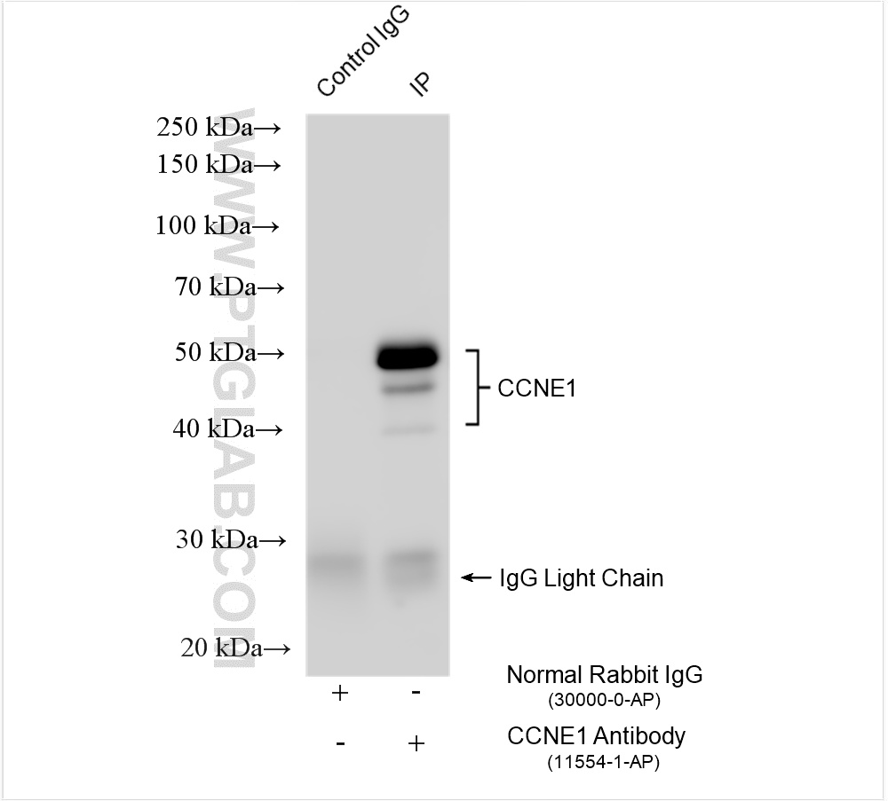 IP experiment of HeLa using 11554-1-AP