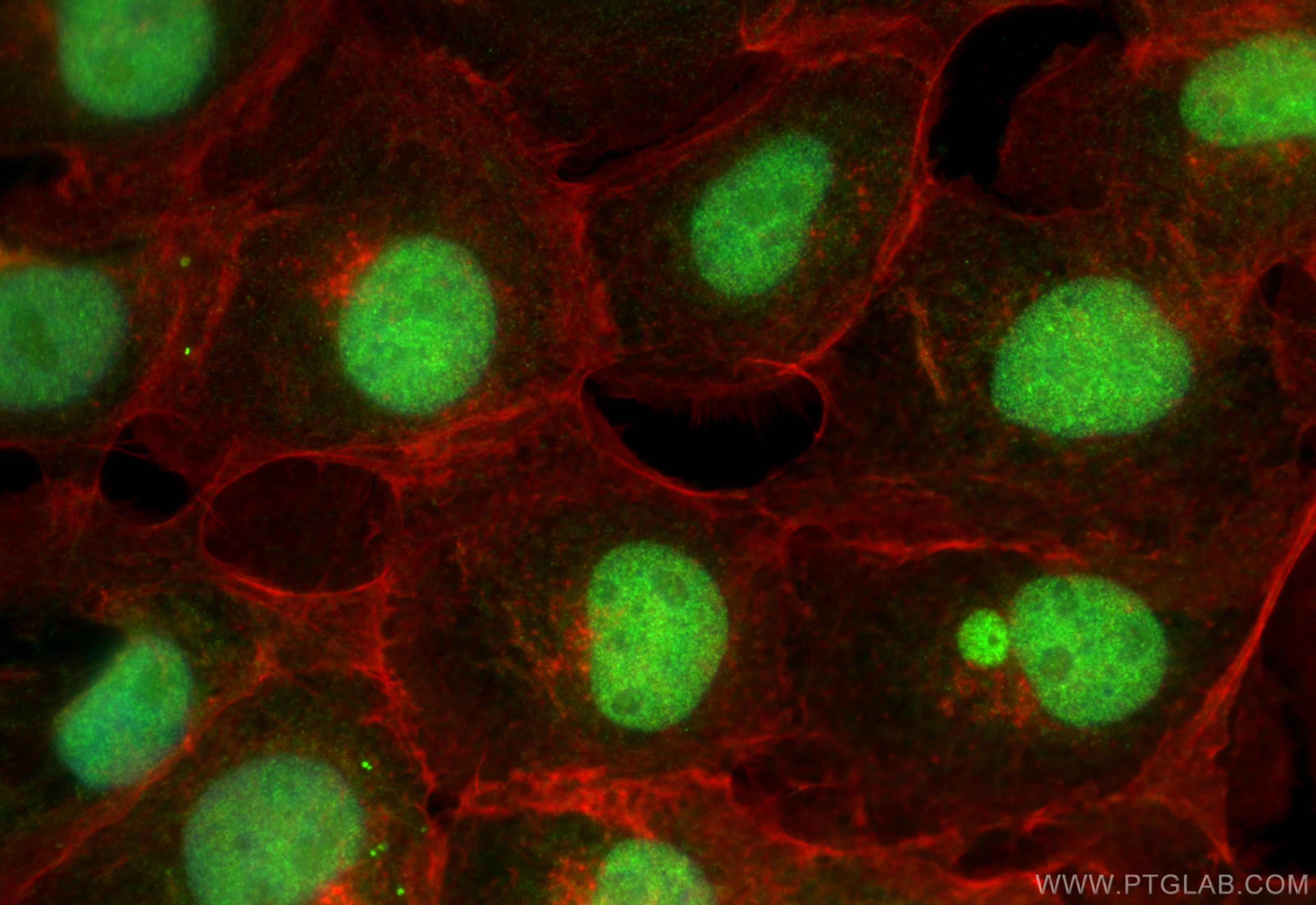 IF Staining of A431 using 10718-1-AP