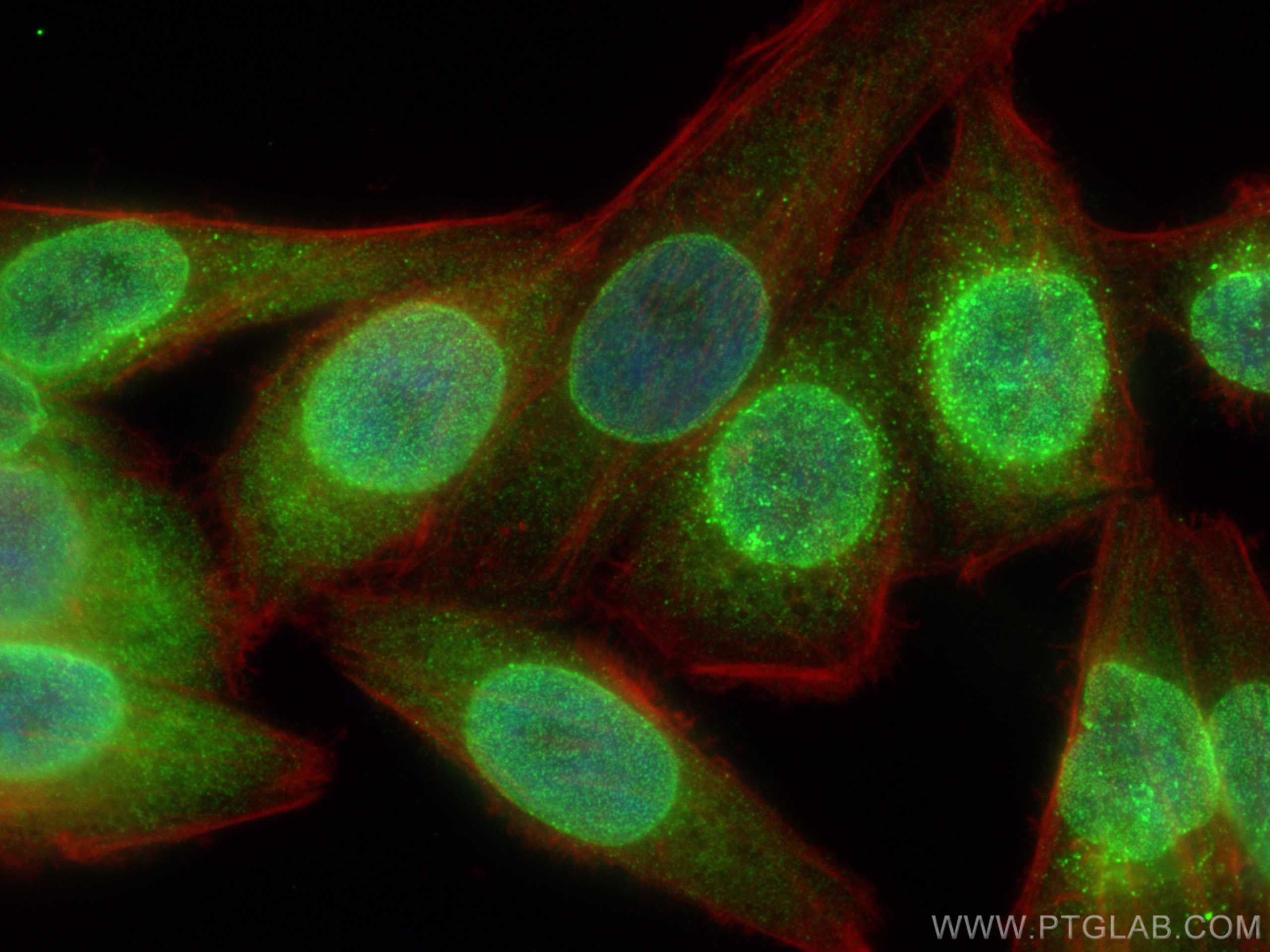 IF Staining of HepG2 using 26743-1-AP (same clone as 26743-1-PBS)