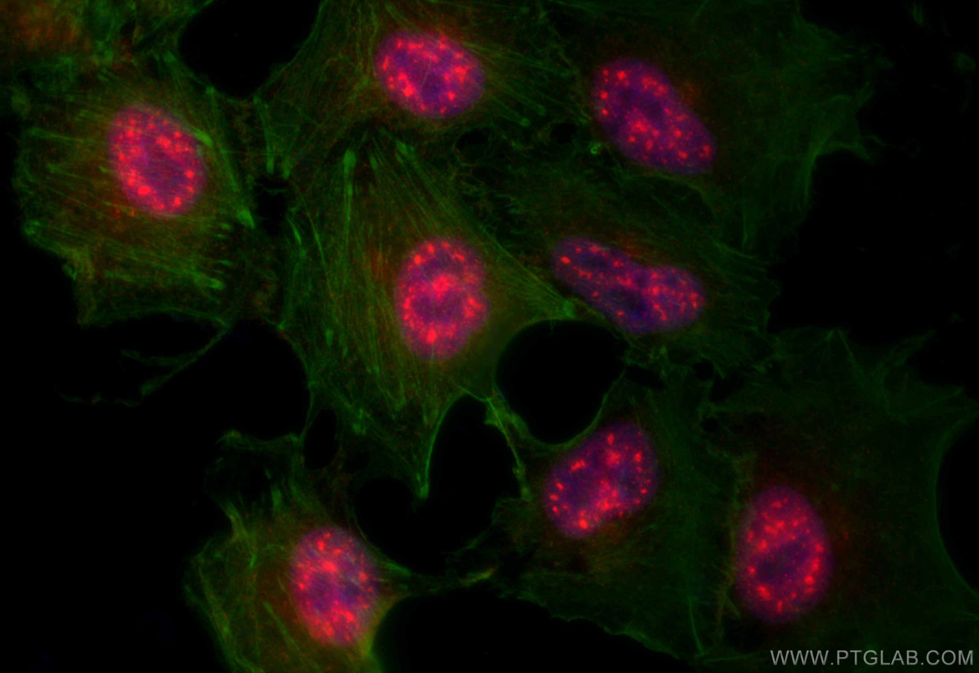 IF Staining of A549 using 18042-1-AP