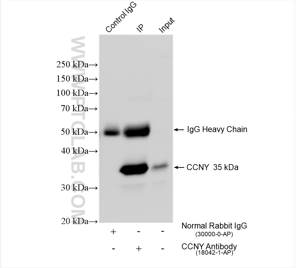 IP experiment of K-562 using 18042-1-AP