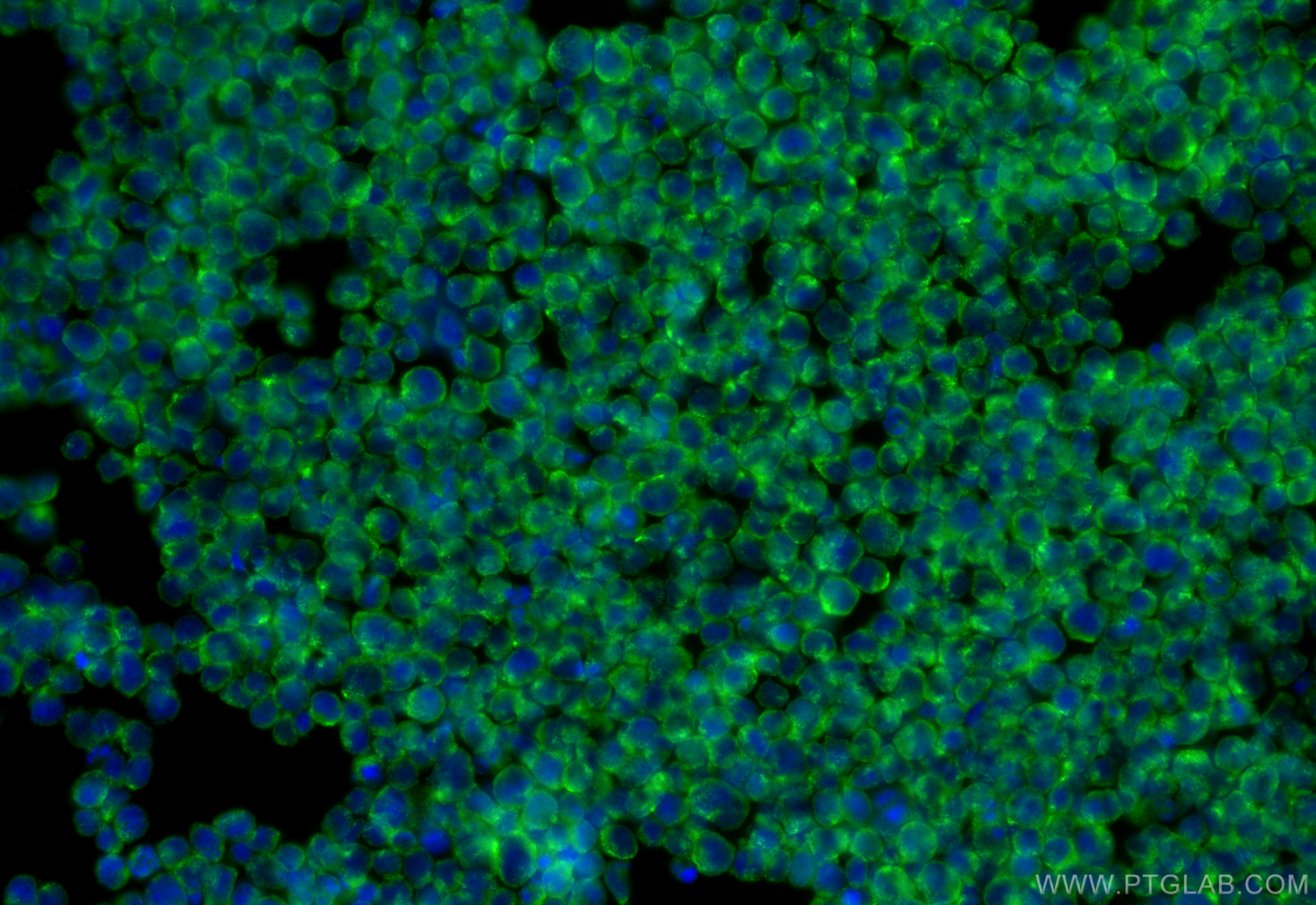 IF Staining of Jurkat using 16153-1-AP