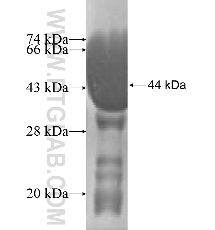 CCRN4L fusion protein Ag1172 SDS-PAGE