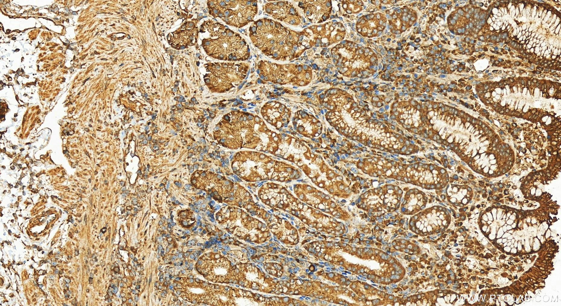 IHC staining of human stomach using 24896-1-AP