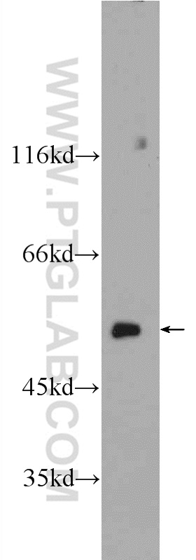 WB analysis of mouse testis using 24896-1-AP