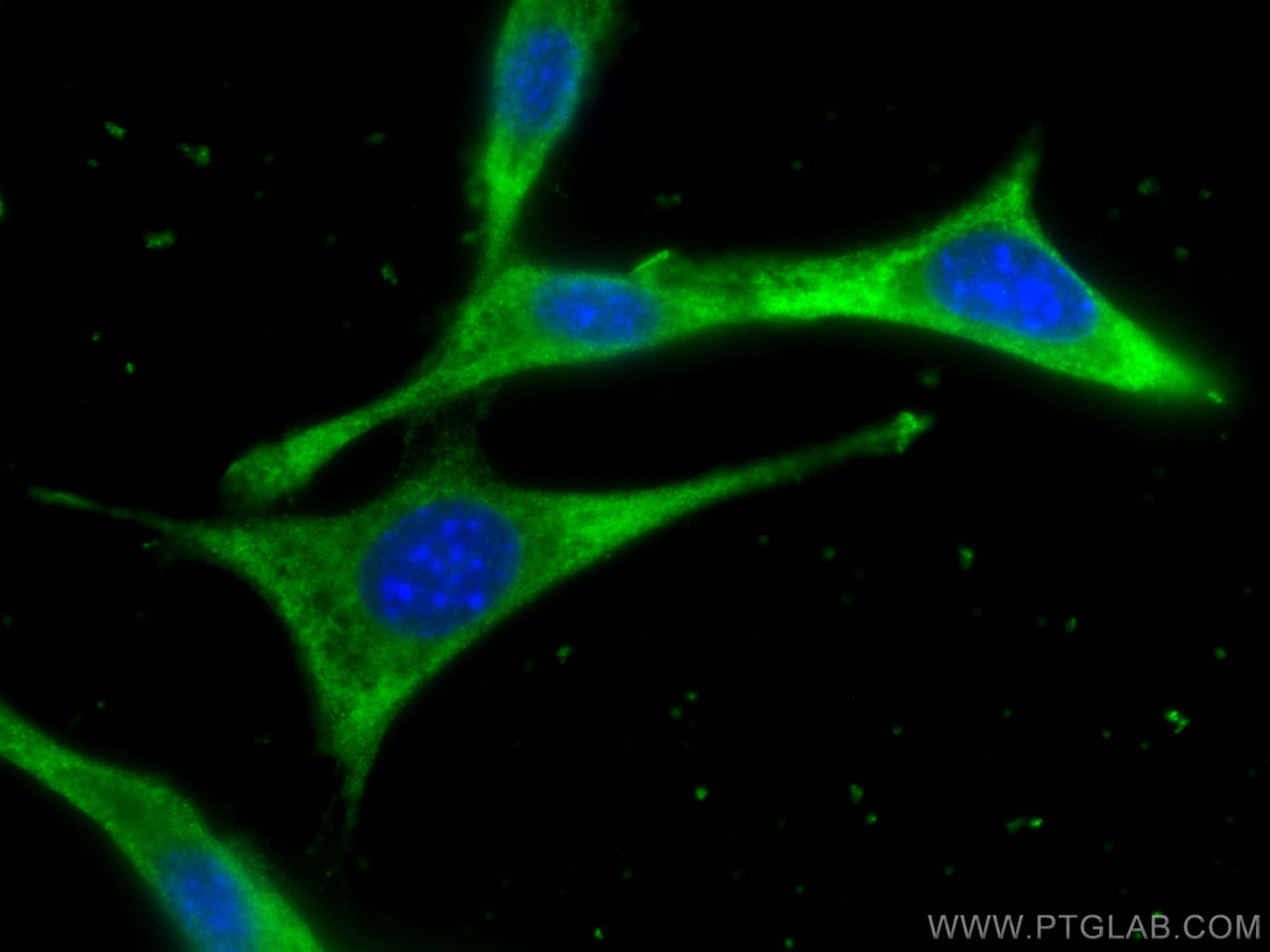 IF Staining of NIH/3T3 using 68214-1-Ig (same clone as 68214-1-PBS)