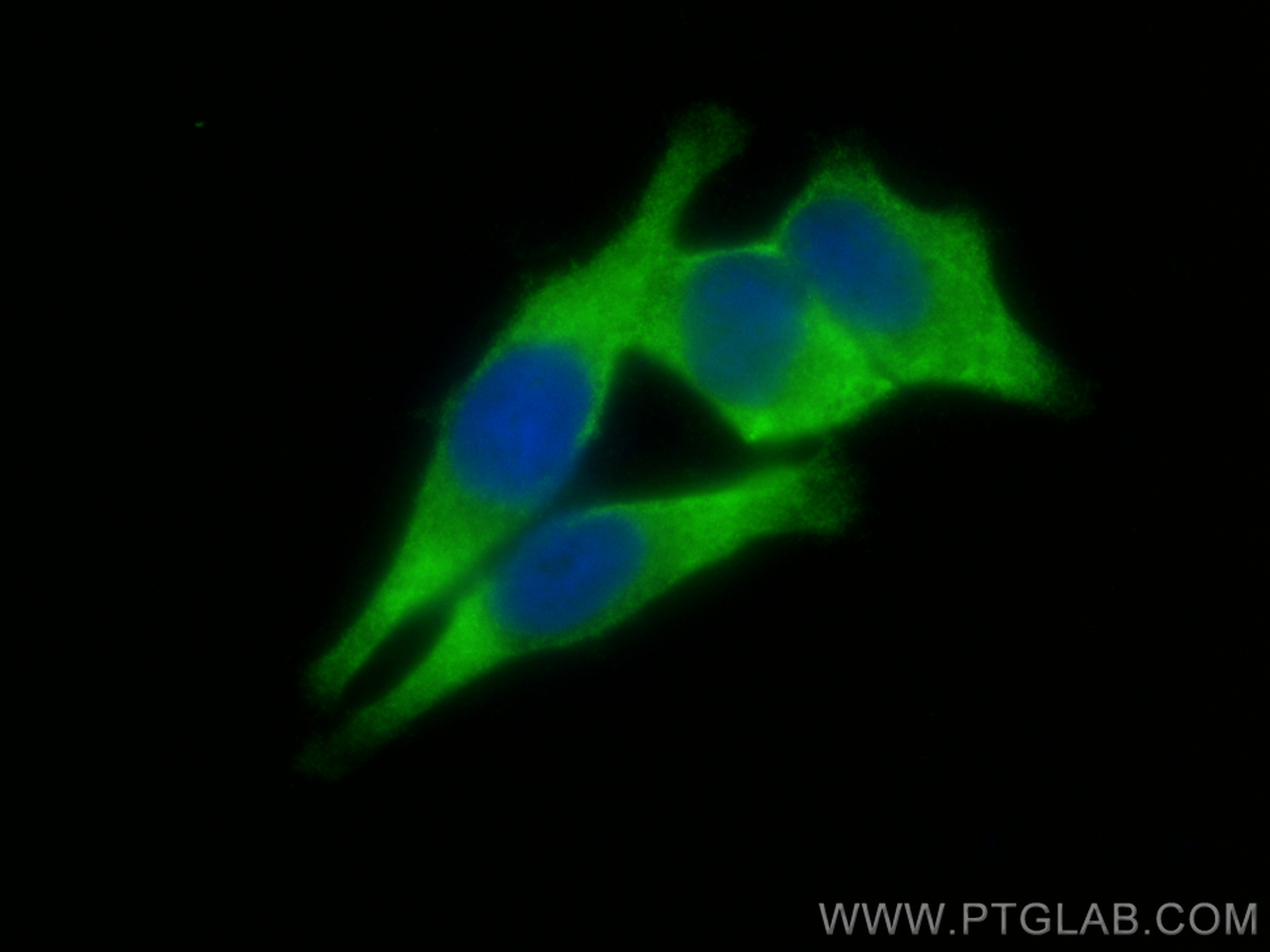 IF Staining of HepG2 using 10571-1-AP