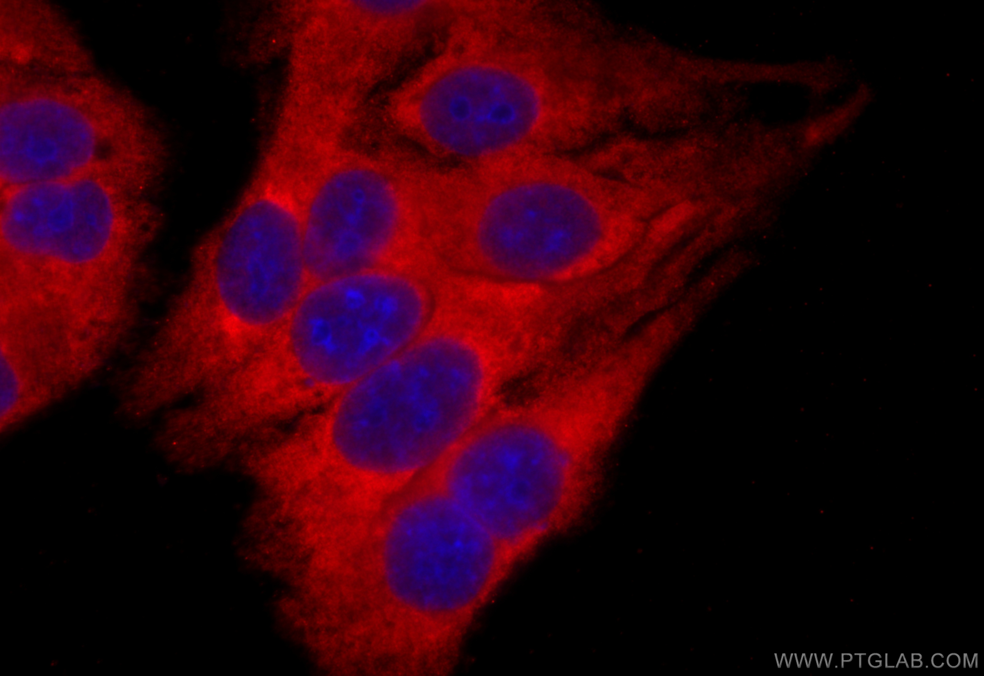 IF Staining of HepG2 using 11603-1-AP