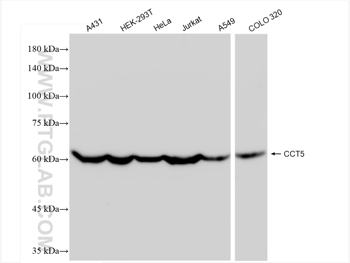 WB analysis using 84310-2-RR