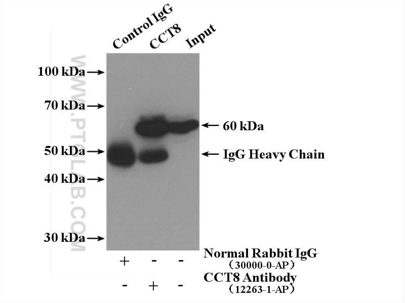 IP experiment of Jurkat using 12263-1-AP