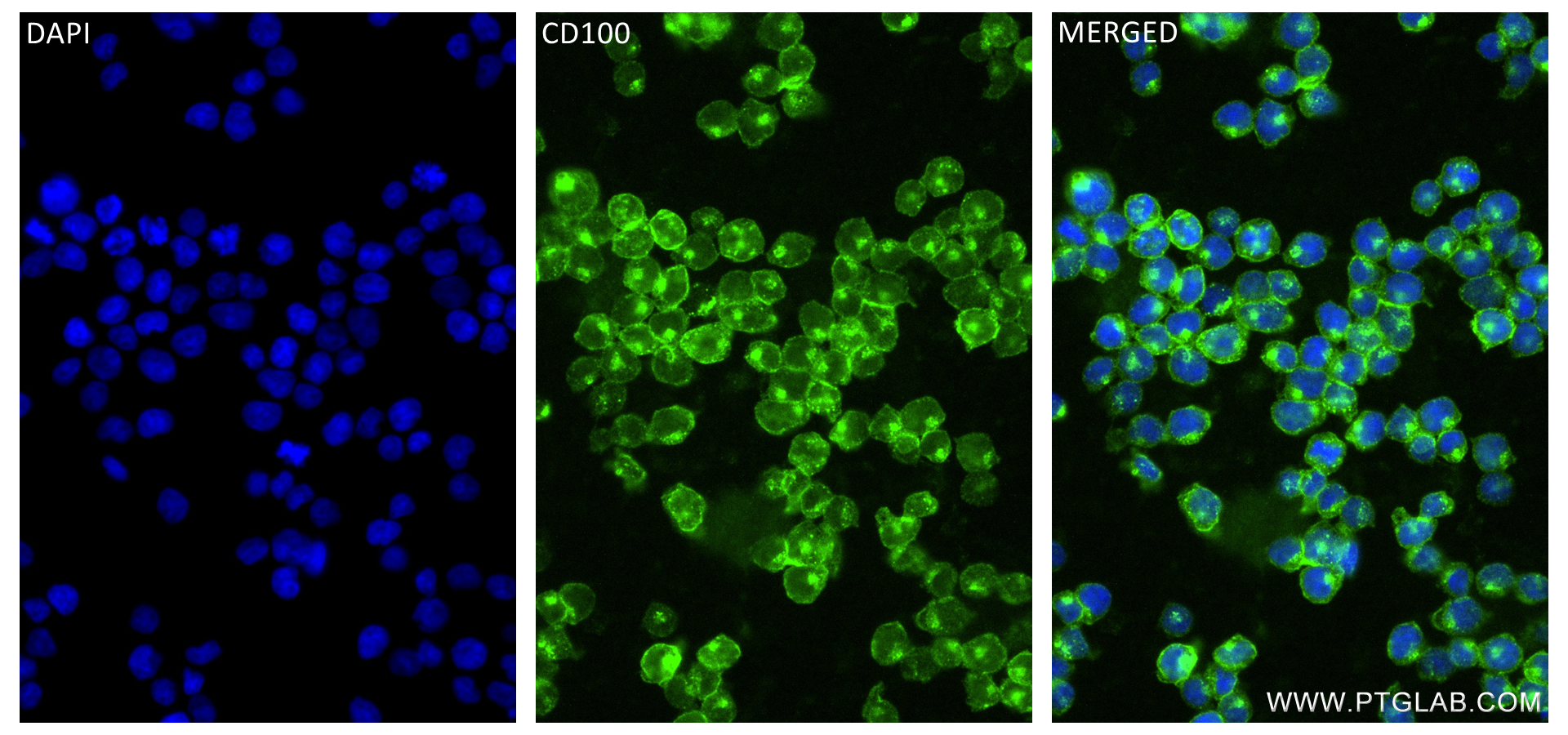 IF Staining of Jurkat using 84465-4-RR (same clone as 84465-4-PBS)