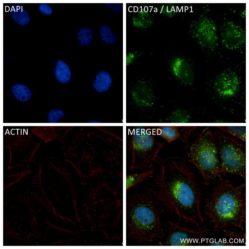 CD107a / LAMP1