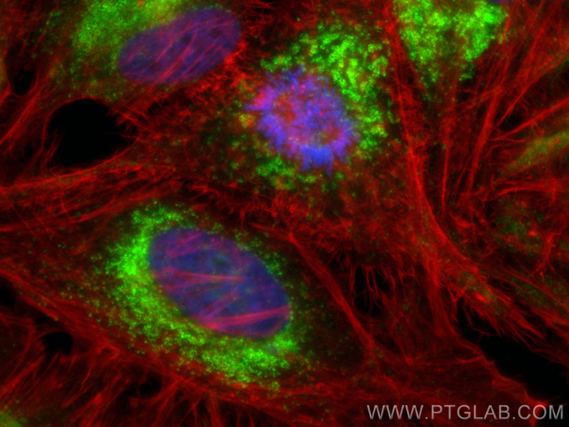 IF Staining of HeLa using 65566-1-MR