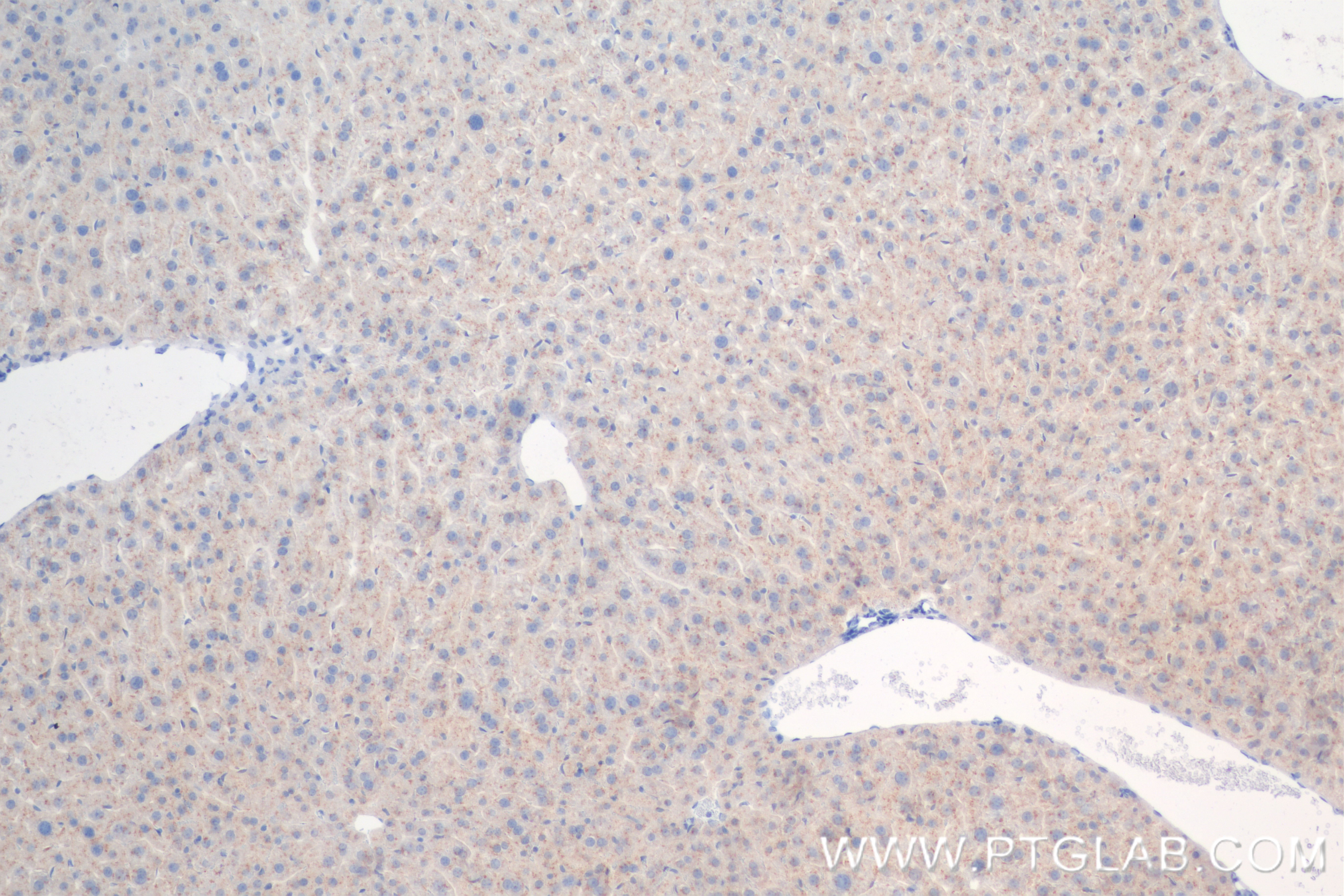 IHC staining of mouse liver using 84474-3-RR