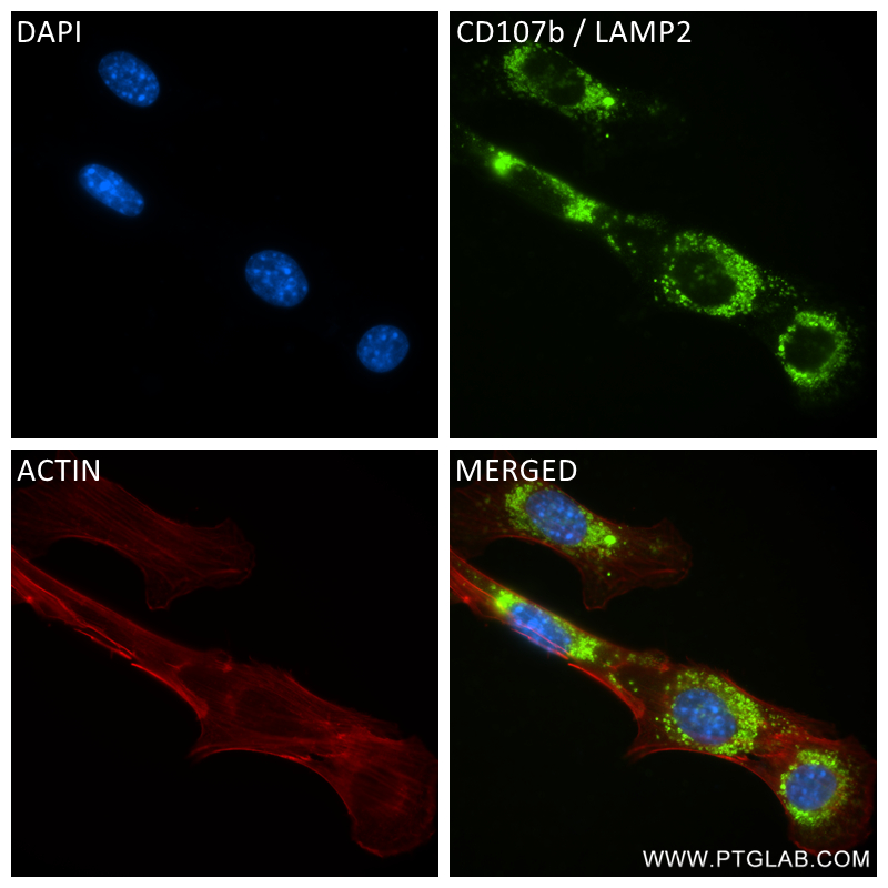 IF Staining of NIH/3T3 using 84474-5-RR (same clone as 84474-5-PBS)