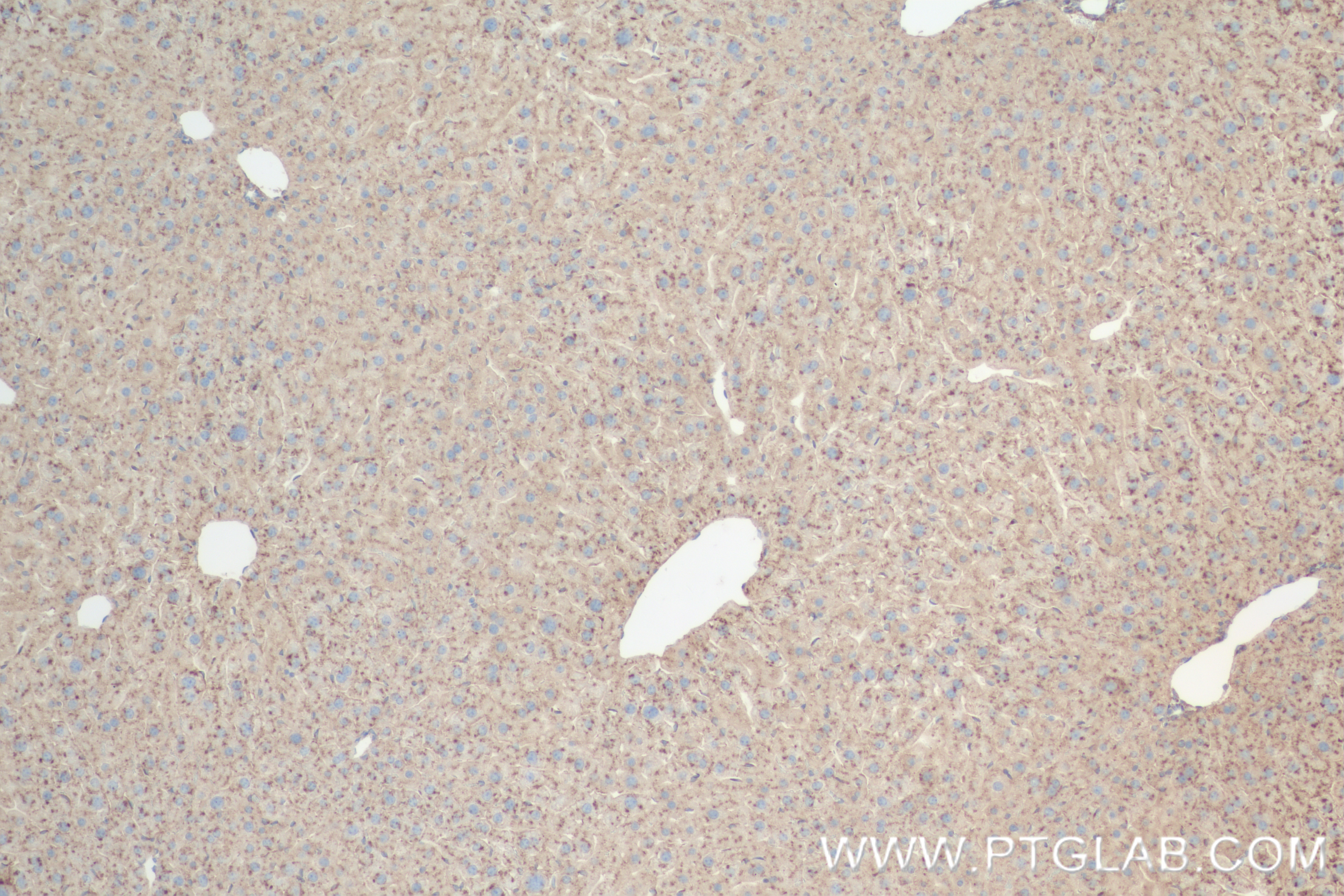 IHC staining of mouse liver using 84474-5-RR (same clone as 84474-5-PBS)