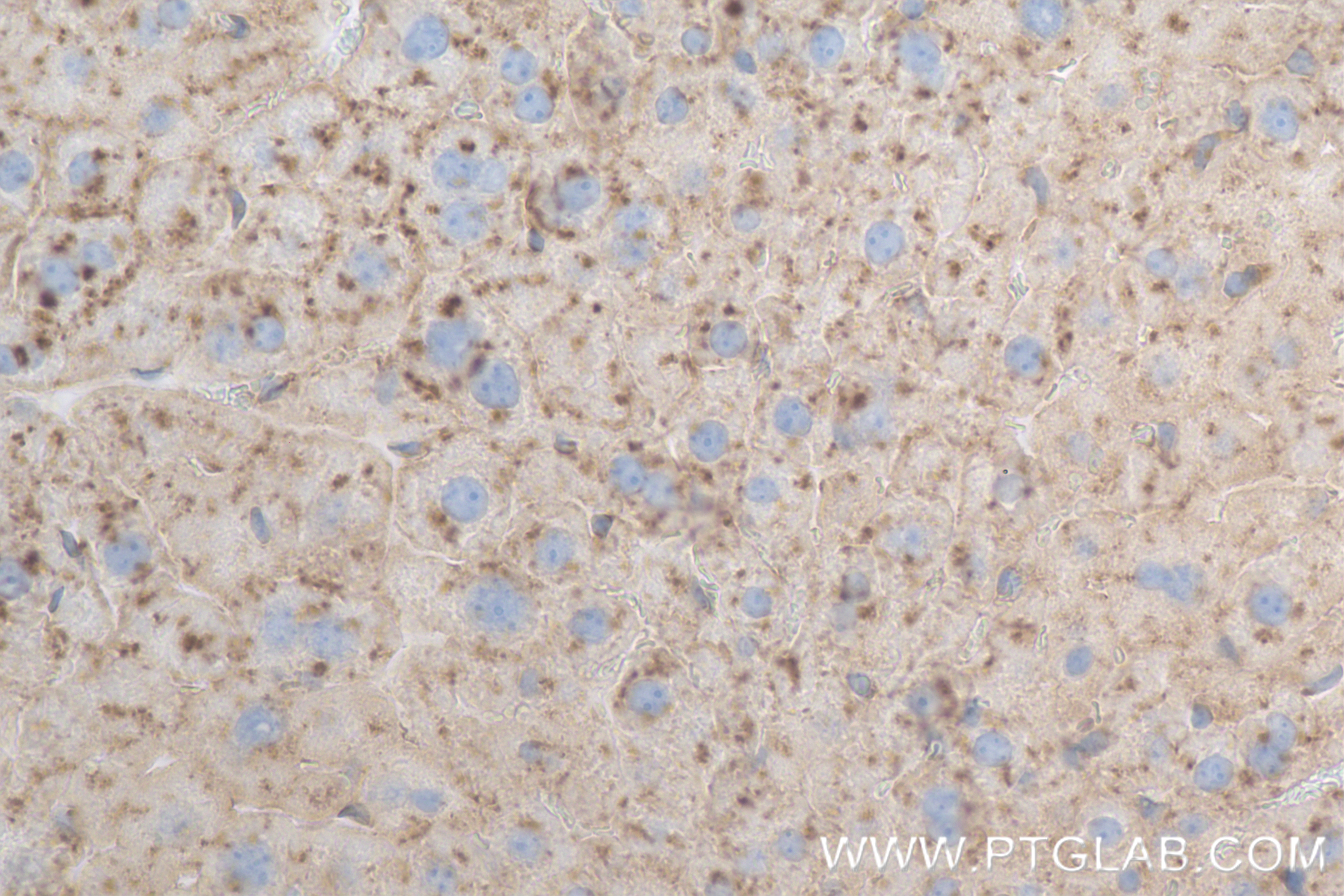 IHC staining of mouse liver using 84474-5-RR (same clone as 84474-5-PBS)