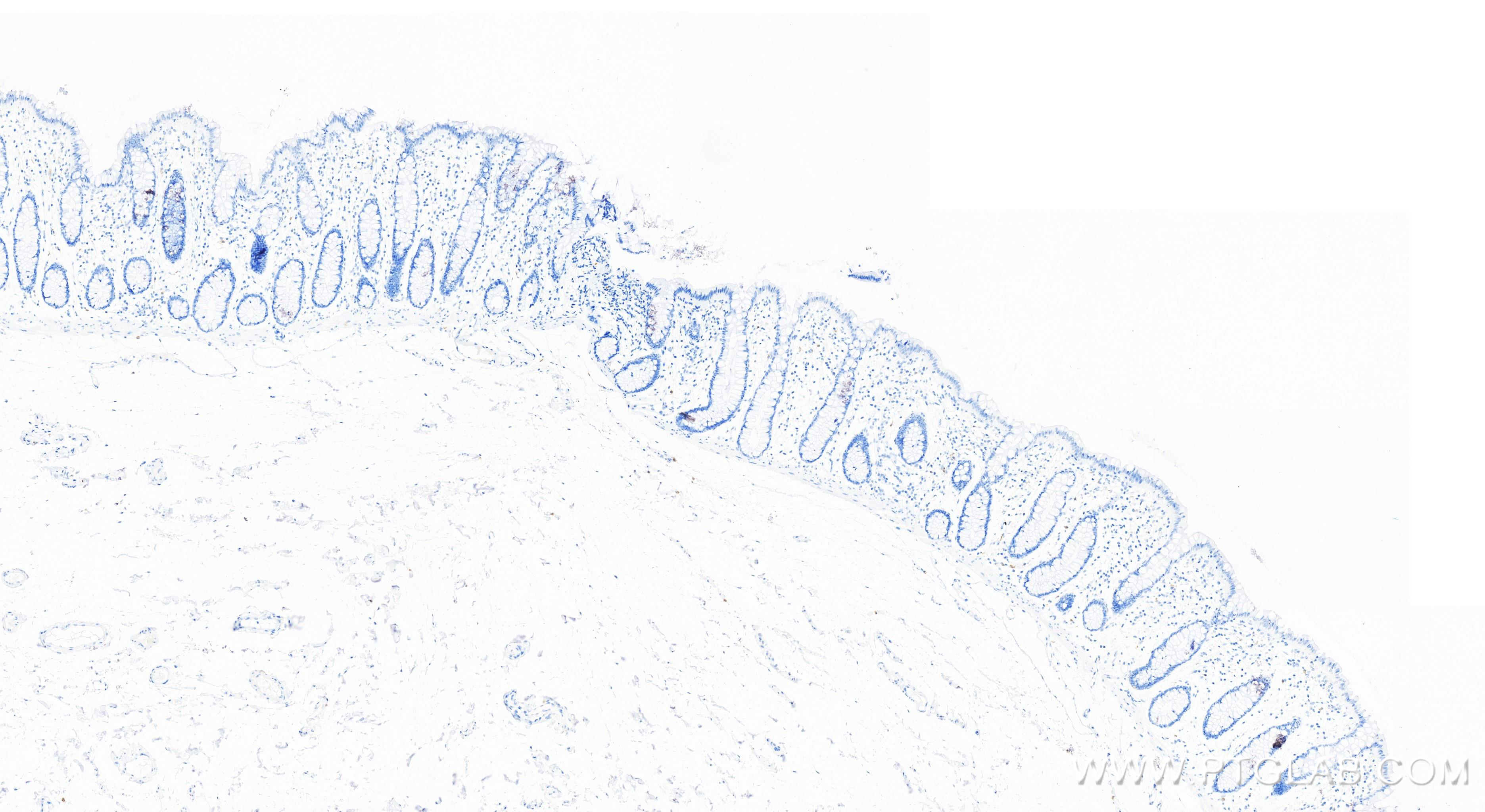 IHC staining of human colon using 84259-3-RR (same clone as 84259-3-PBS)