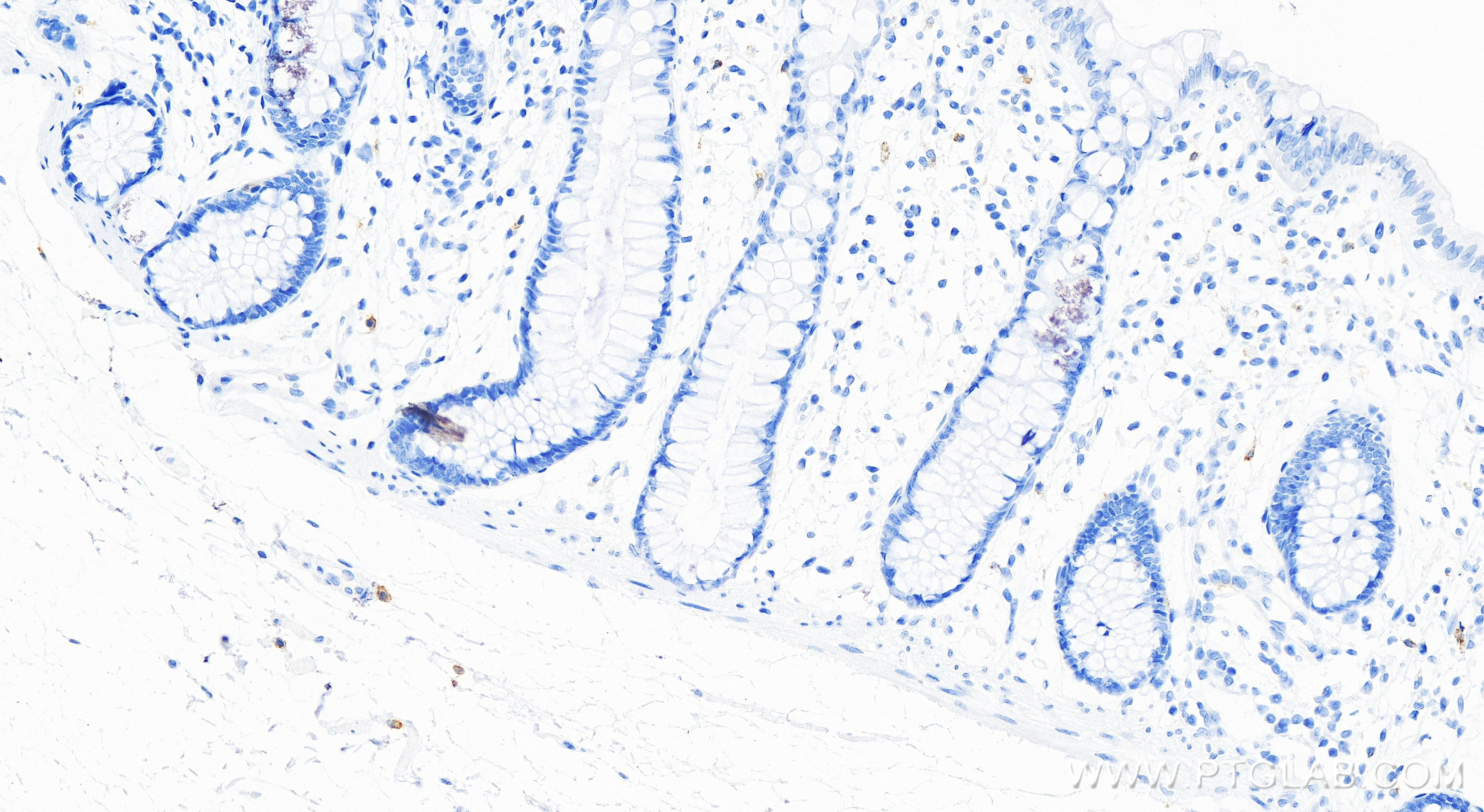 IHC staining of human colon using 84259-3-RR (same clone as 84259-3-PBS)