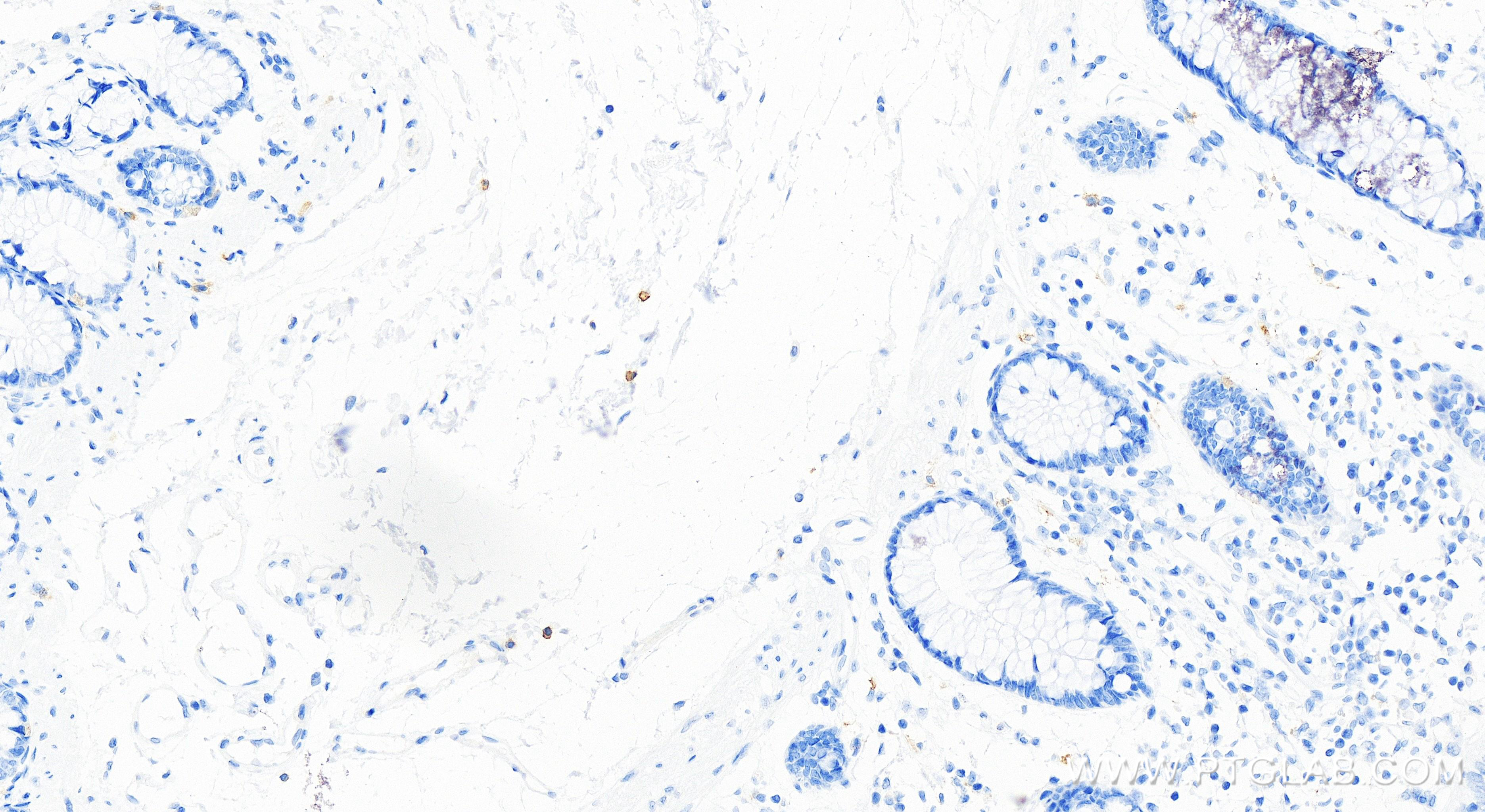 IHC staining of human colon using 84259-3-RR (same clone as 84259-3-PBS)