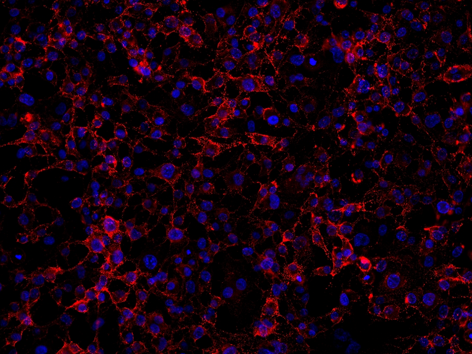 IF Staining of HUVEC using 65186-1-Ig (same clone as 65186-1-PBS)