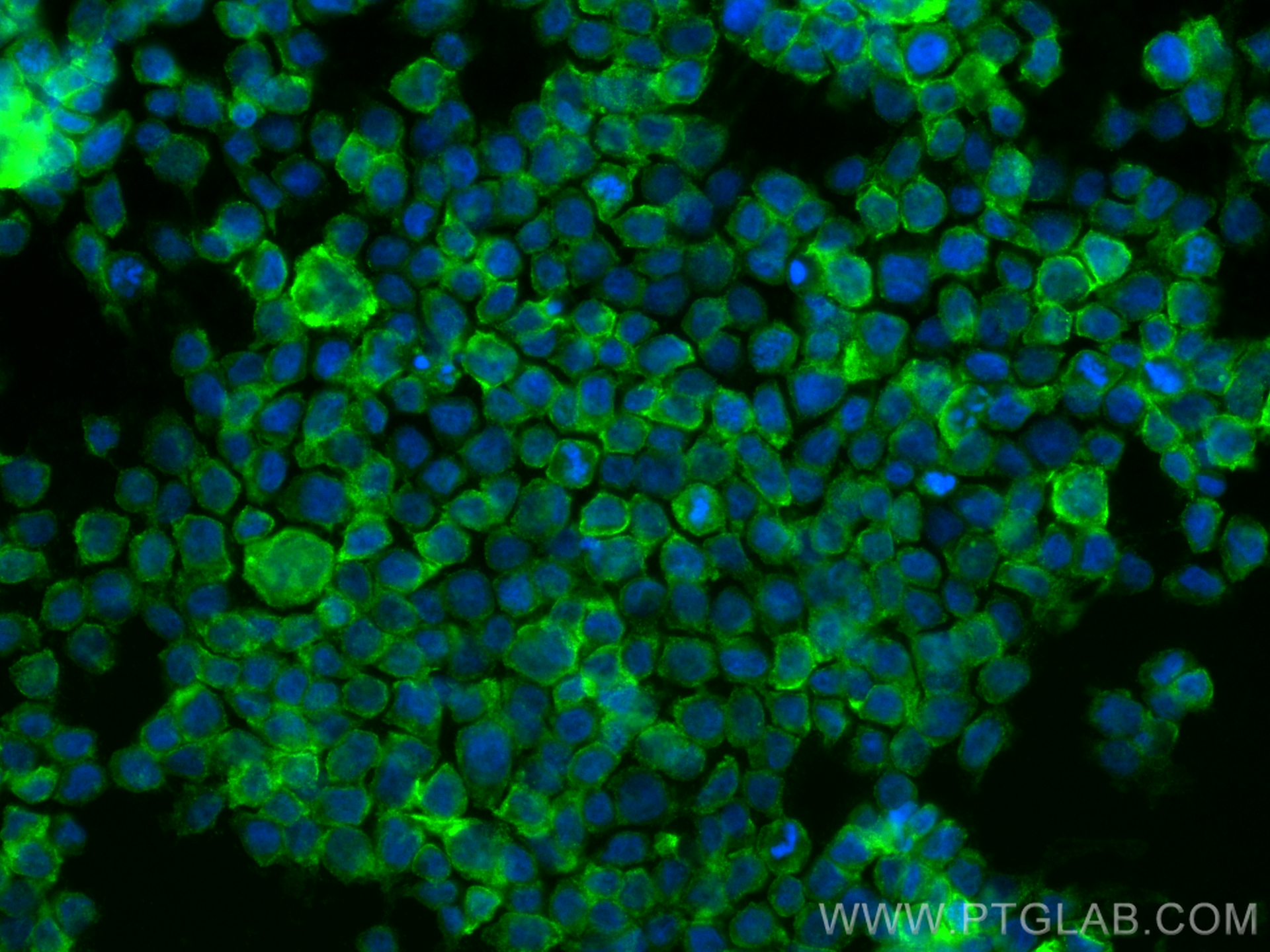 IF Staining of THP-1 using 65186-1-Ig (same clone as 65186-1-PBS)