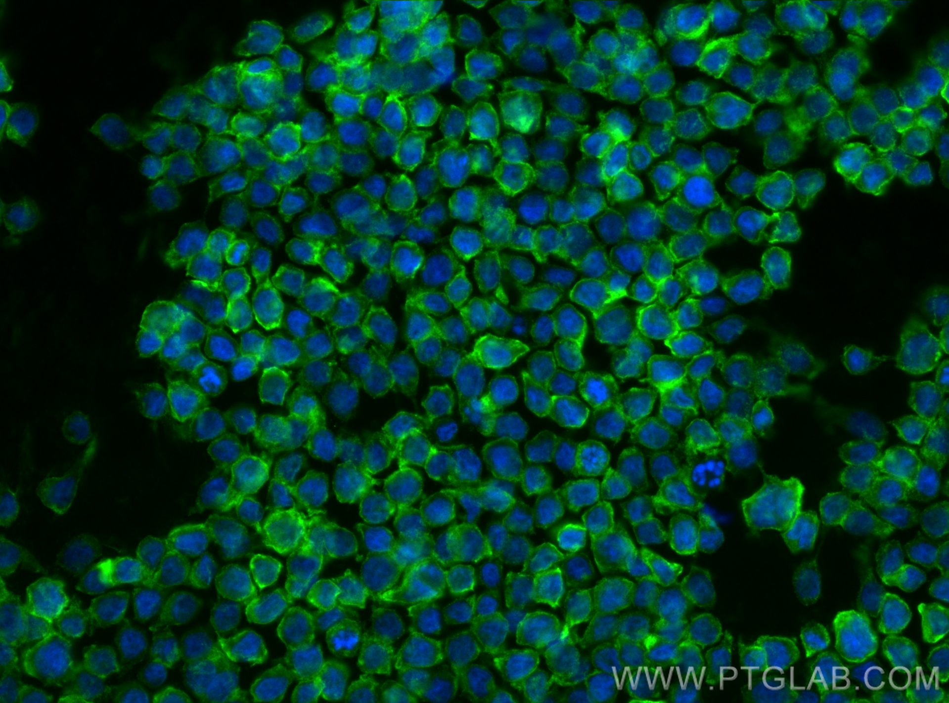 IF Staining of THP-1 using 65633-1-MR (same clone as 65633-1-PBS)