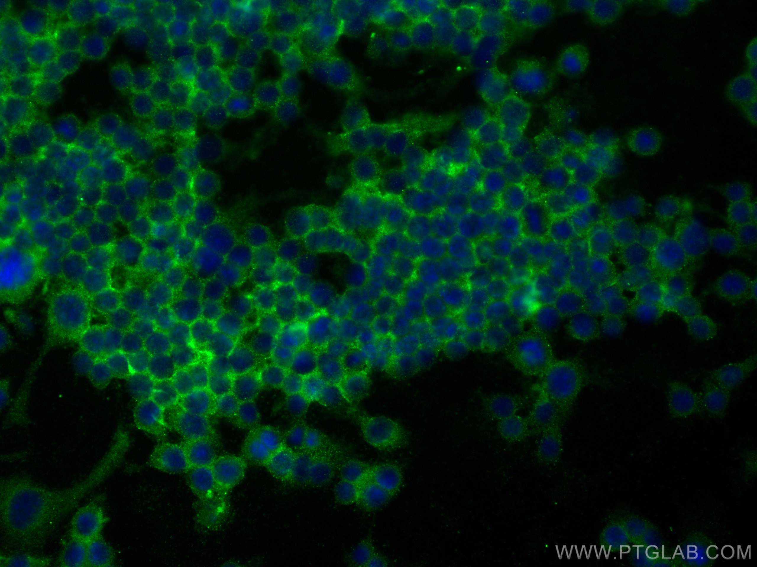 IF Staining of RAW 264.7 using 17000-1-AP