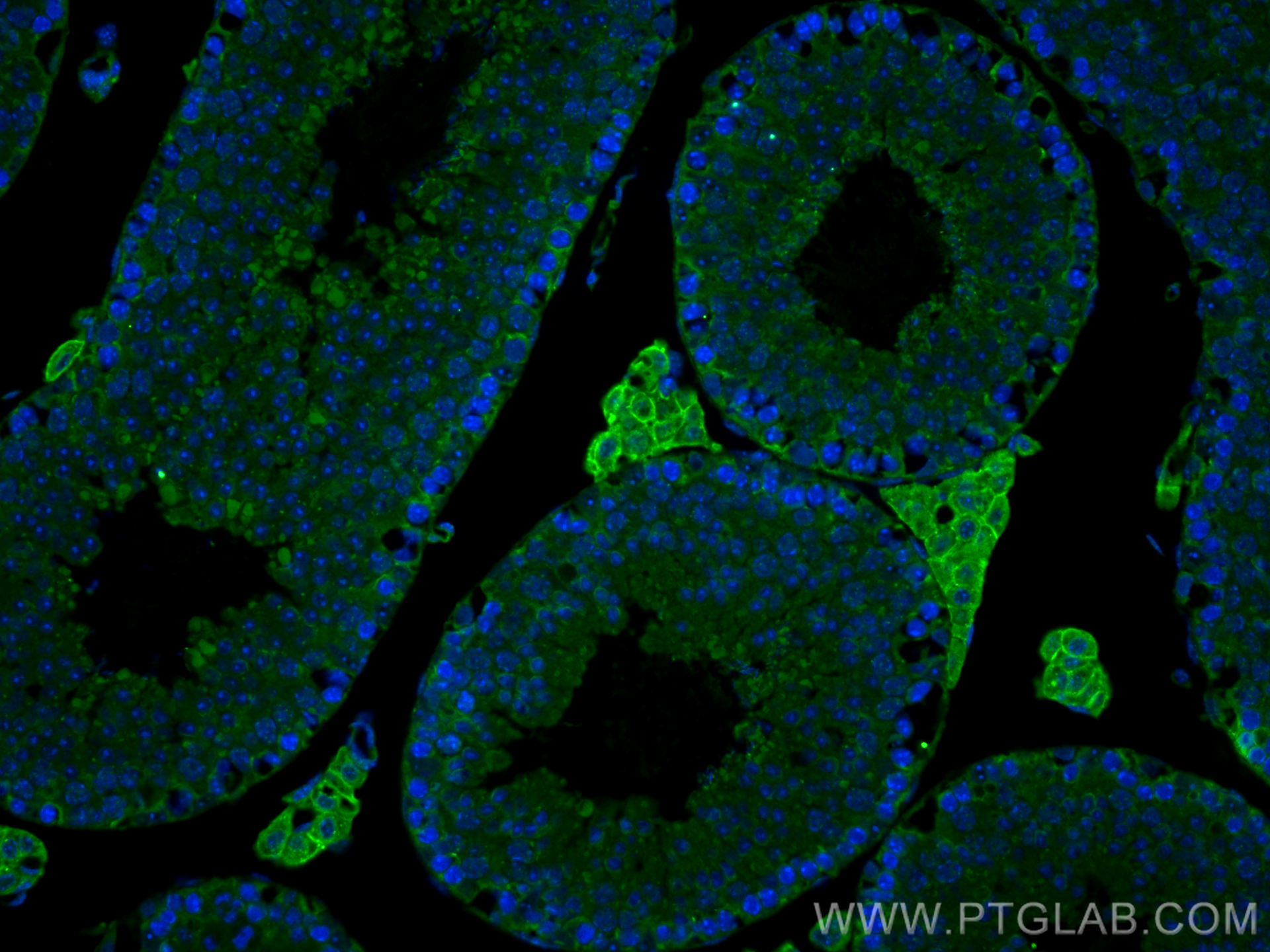 IF Staining of mouse testis using 17000-1-AP