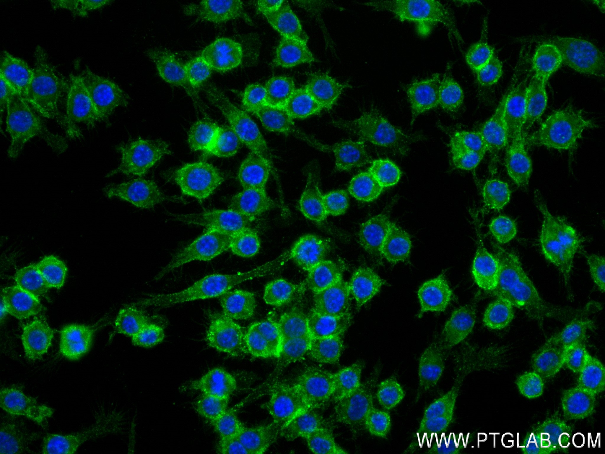 IF Staining of RAW 264.7 using 83297-8-RR