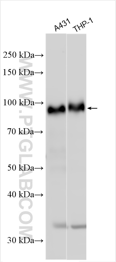 CD141/Thrombomodulin