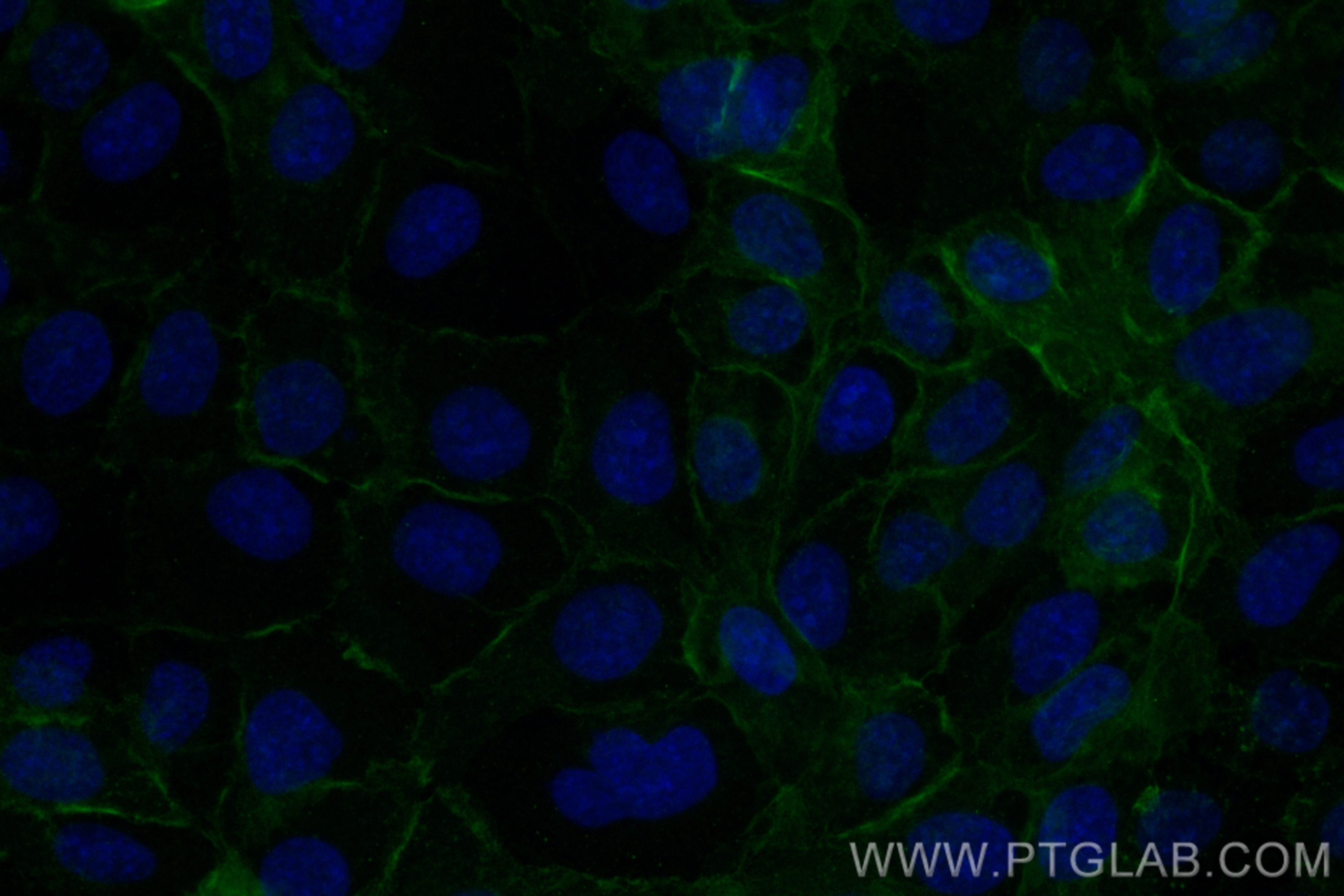 CD141/Thrombomodulin