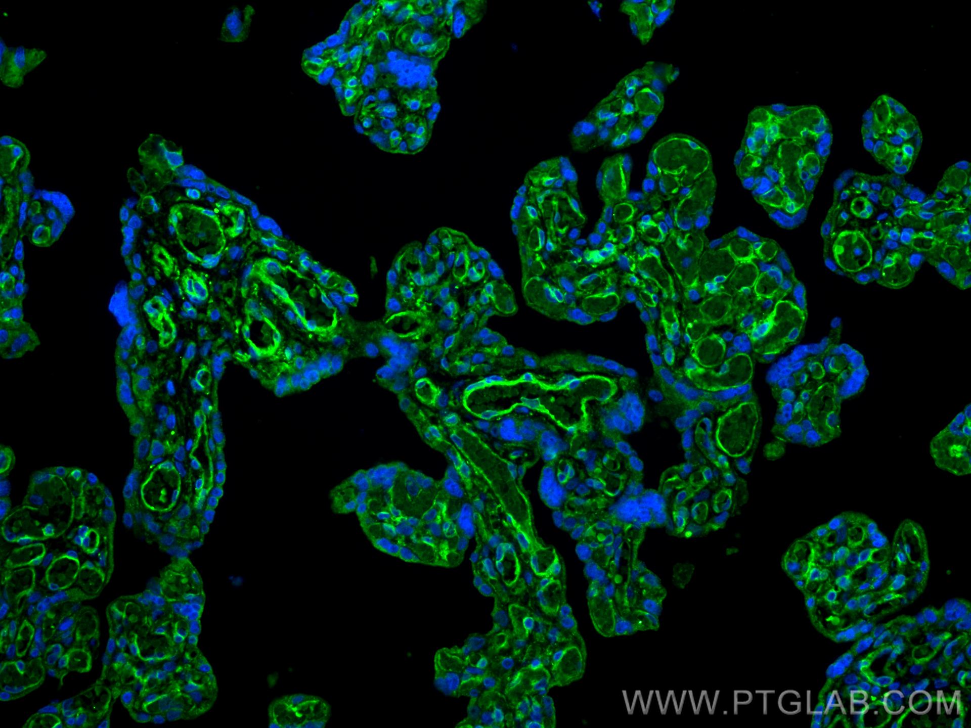 IF Staining of human placenta using 66153-1-Ig