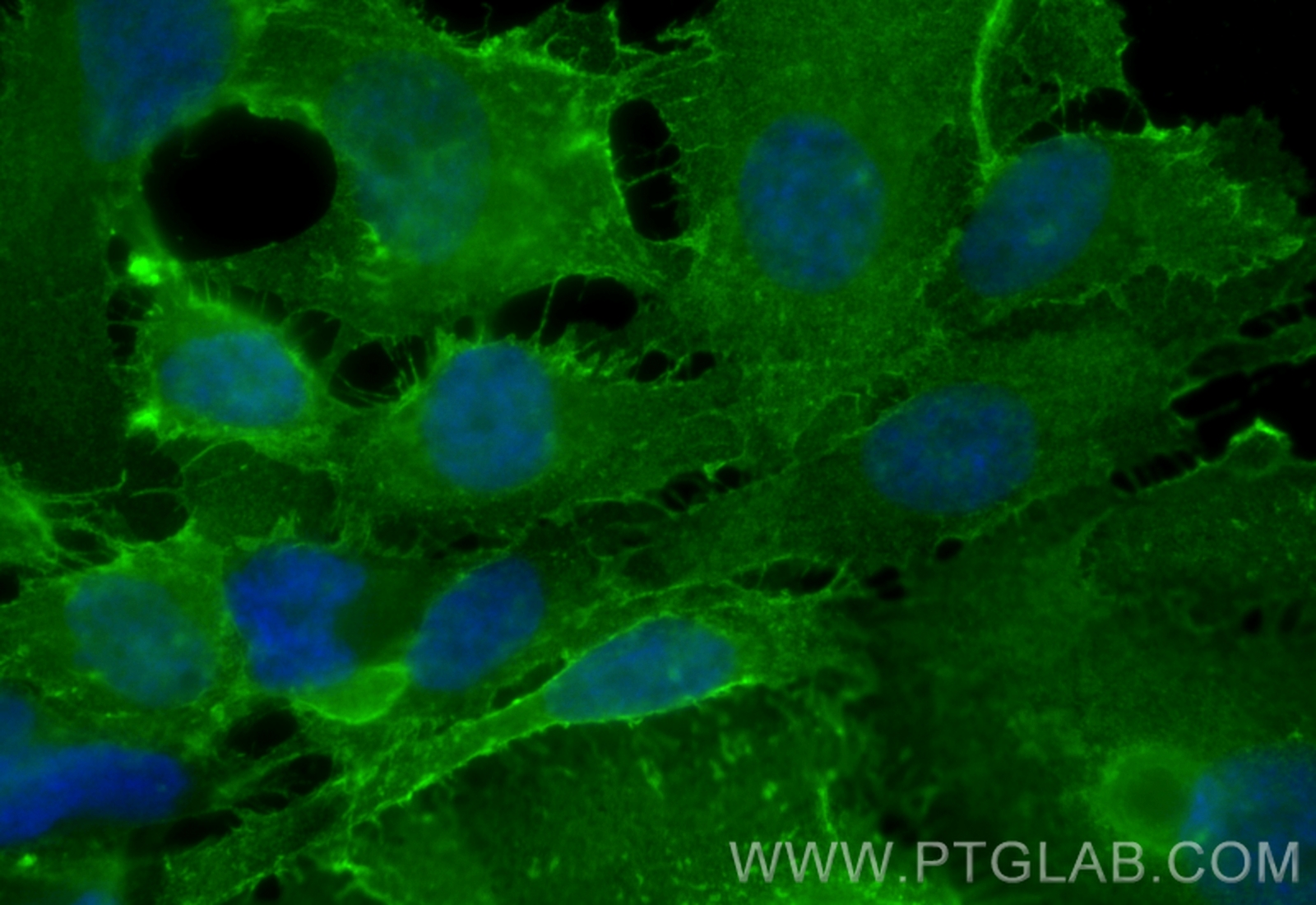 IF Staining of HUVEC using CL488-17564