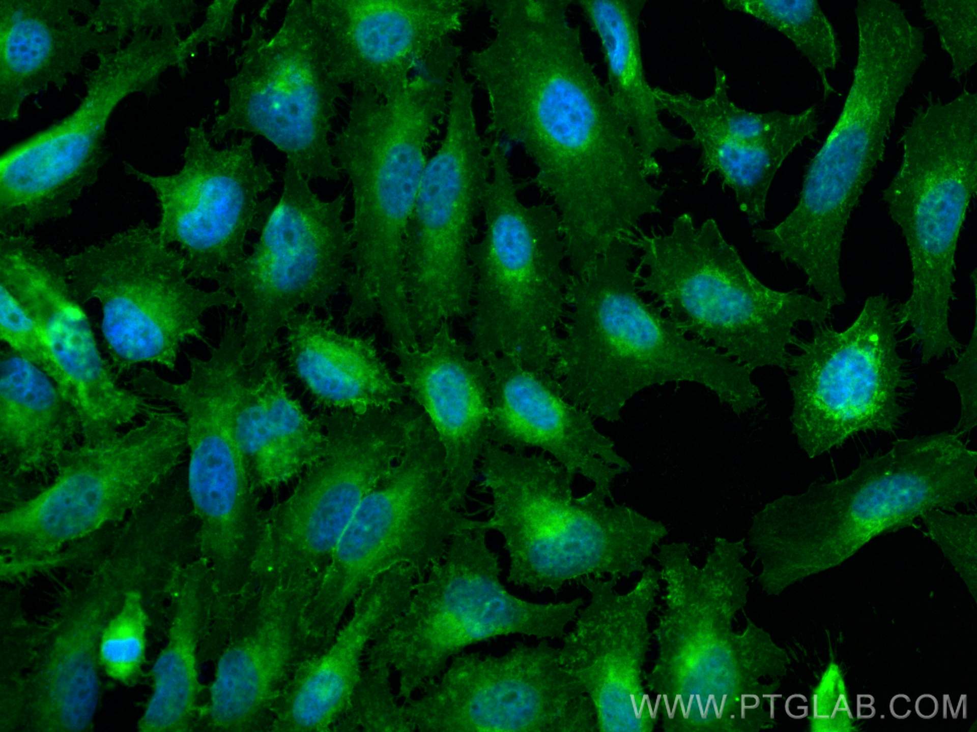 IF Staining of HeLa using 30880-1-AP