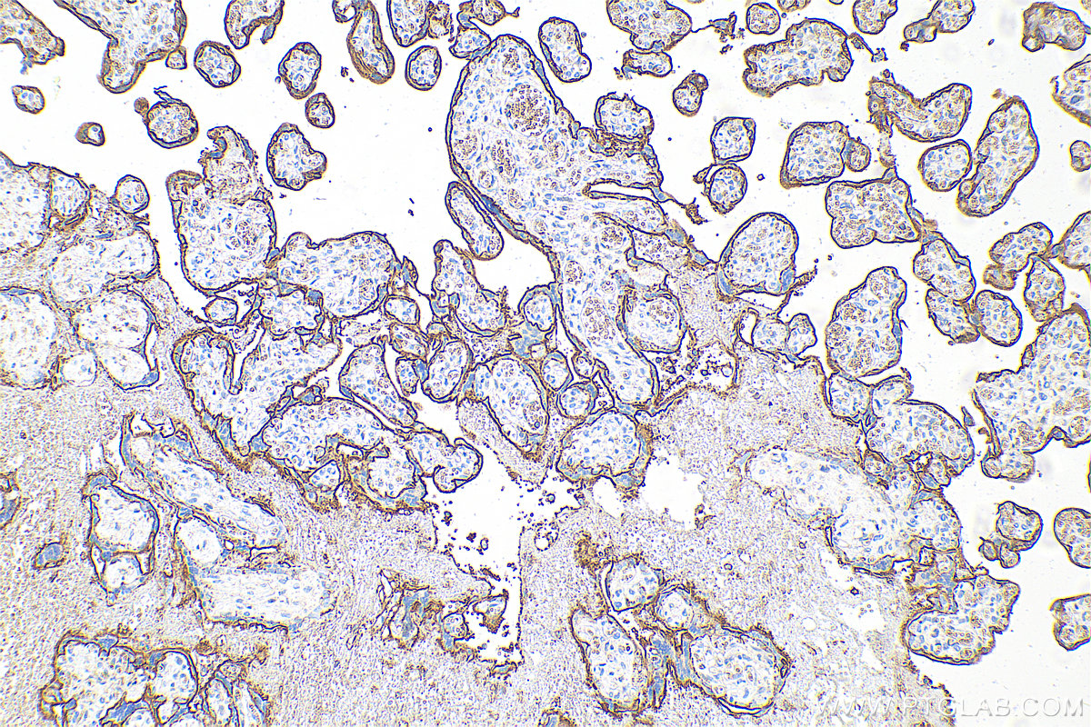 IHC staining of human placenta using 30880-1-AP