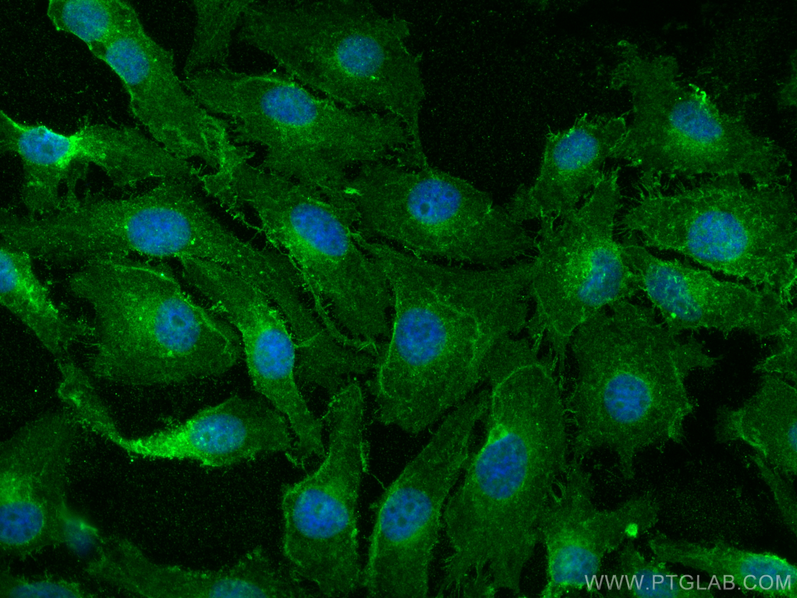 IF Staining of HeLa using 66443-1-Ig