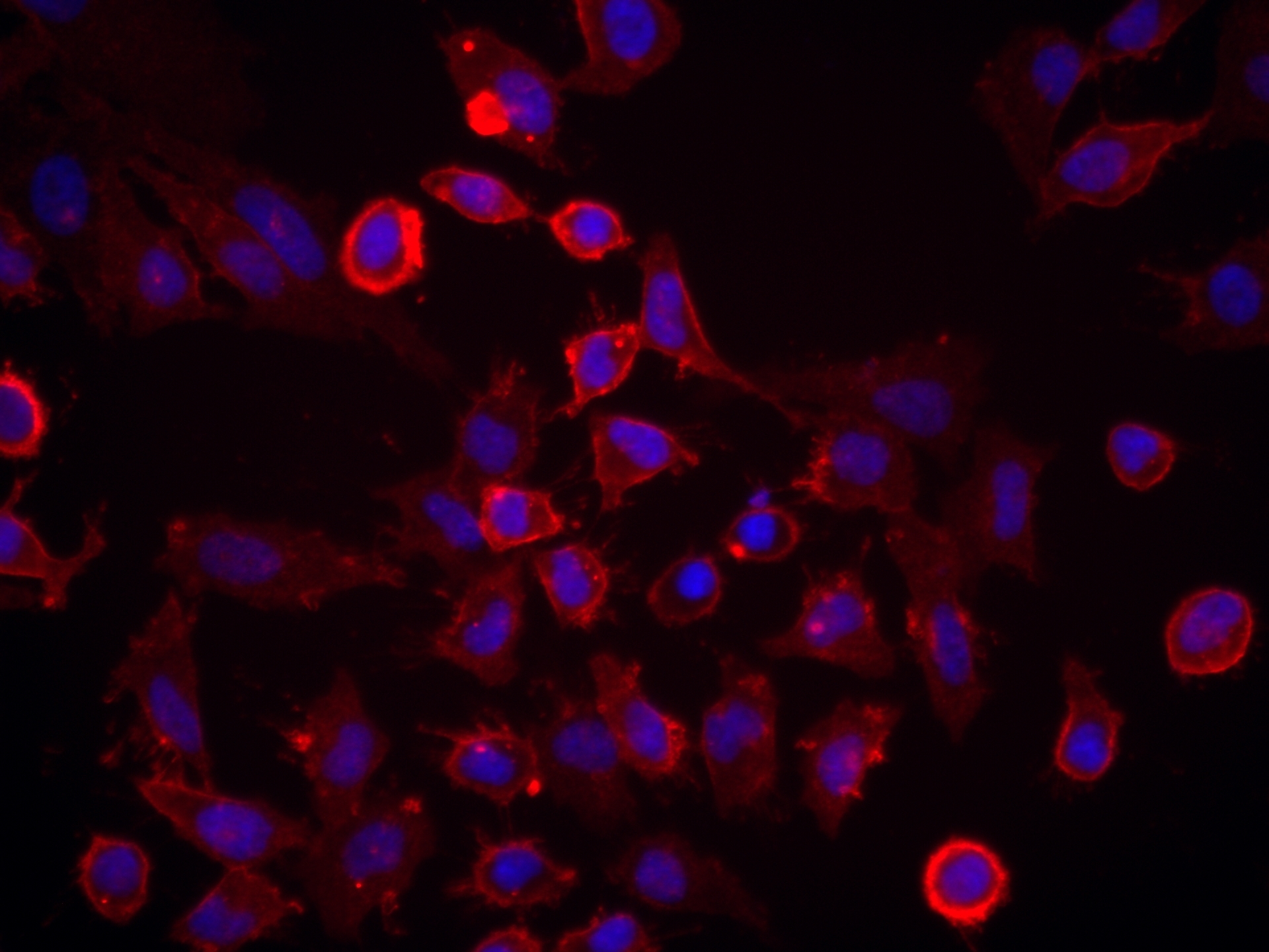 IF Staining of HeLa using 82909-7-RR (same clone as 82909-7-PBS)