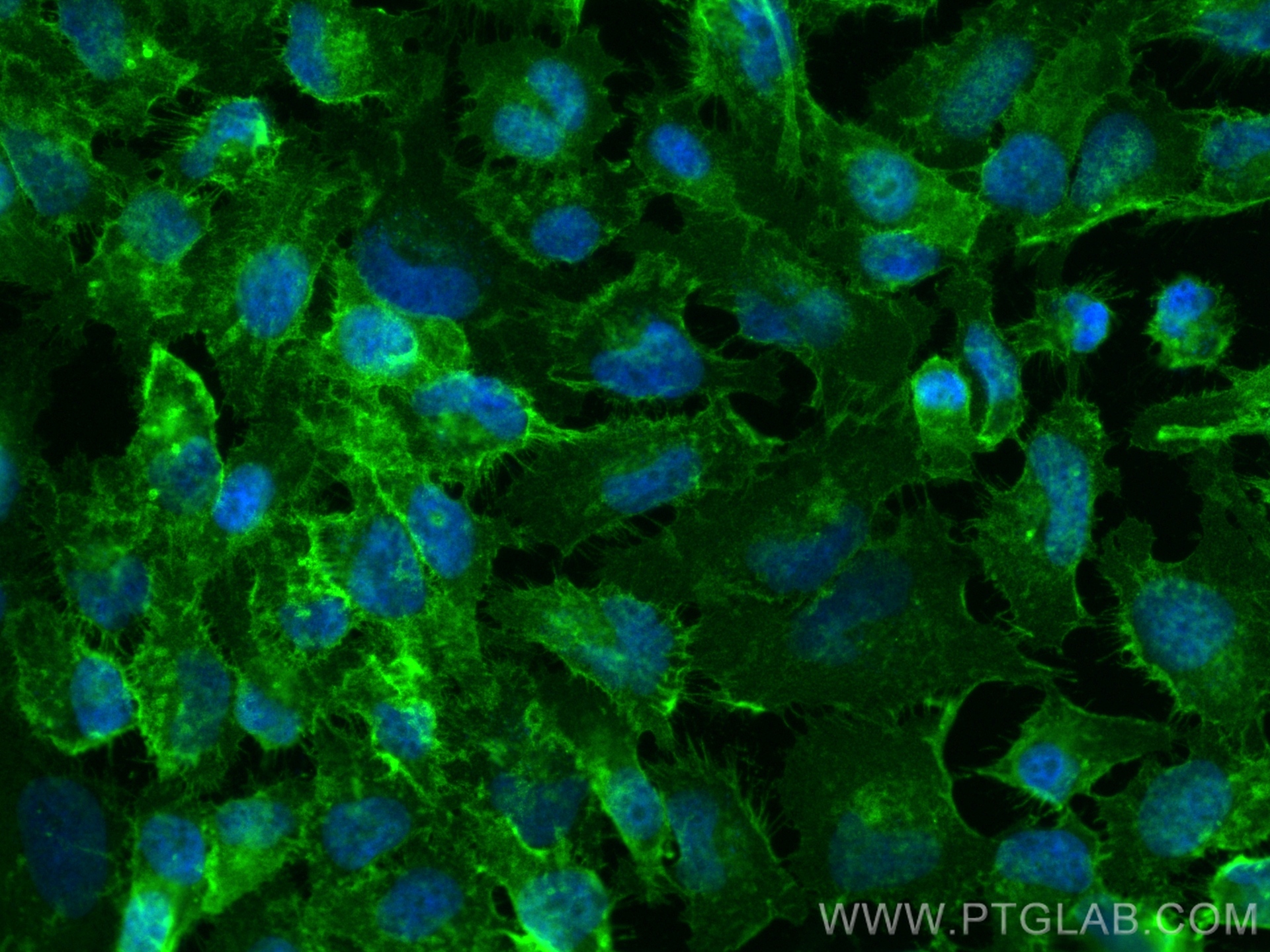 IF Staining of HeLa using 82909-7-RR