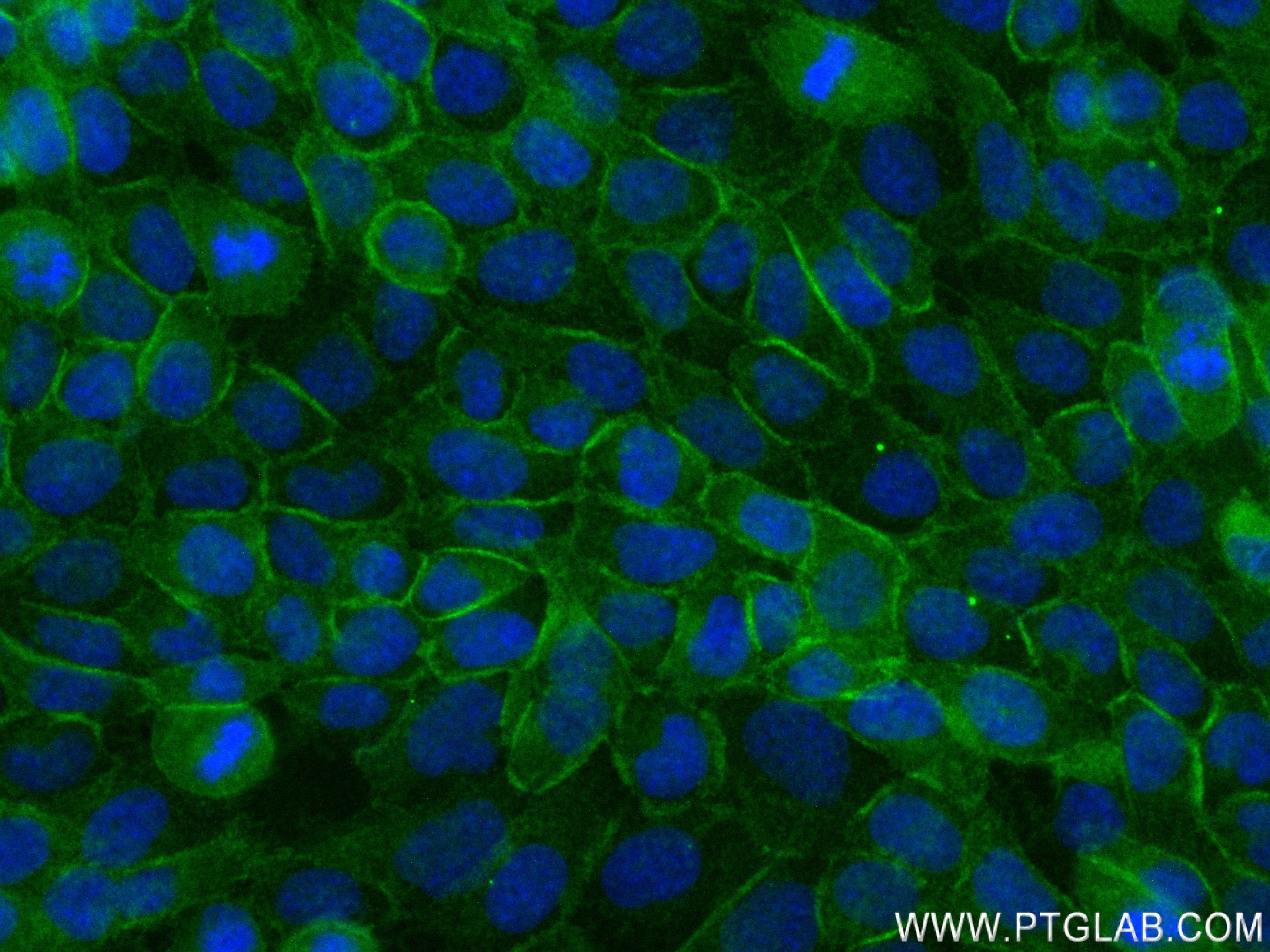 IF Staining of A431 using 84138-1-RR (same clone as 84138-1-PBS)