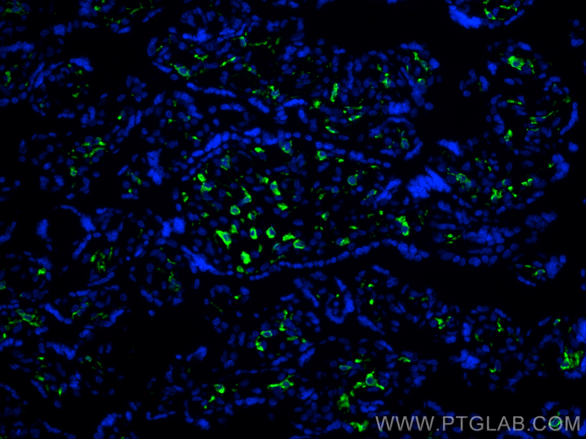 IF Staining of human placenta using 16646-1-AP