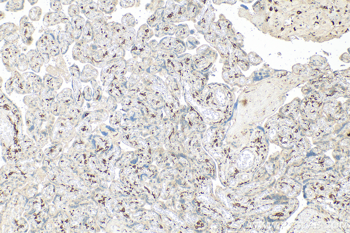 IHC staining of human placenta using 16646-1-AP