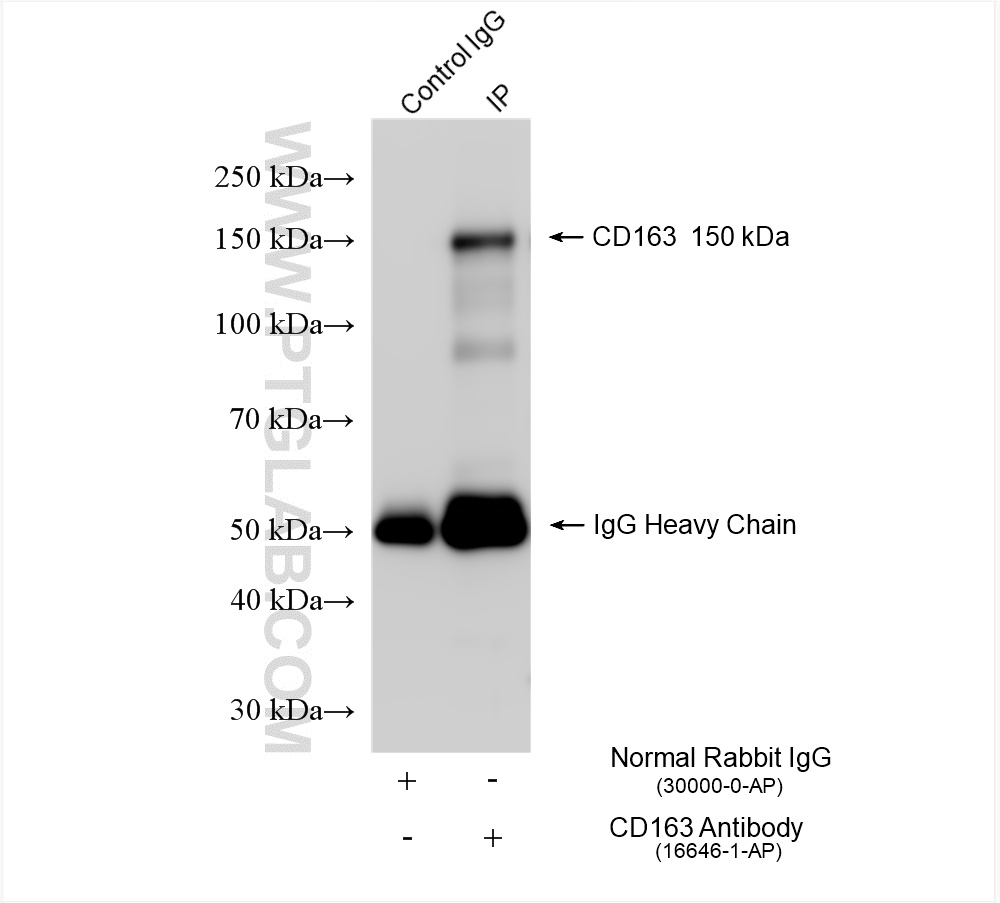 IP experiment of human placenta using 16646-1-AP