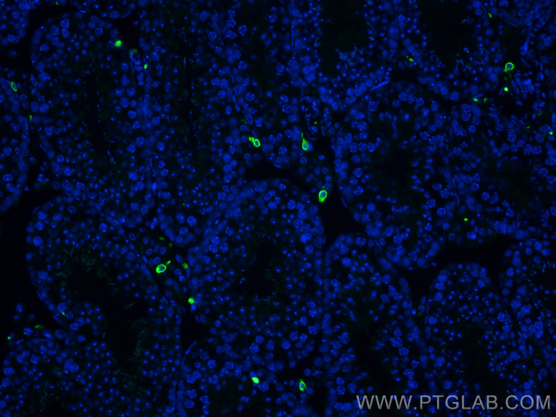 IF Staining of mouse testis using 31024-1-AP