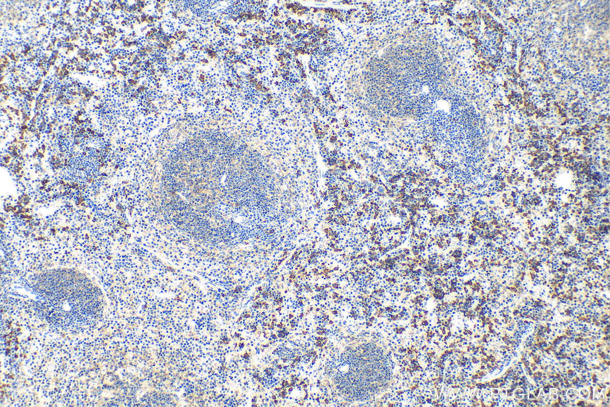 IHC staining of mouse spleen using 31024-1-AP